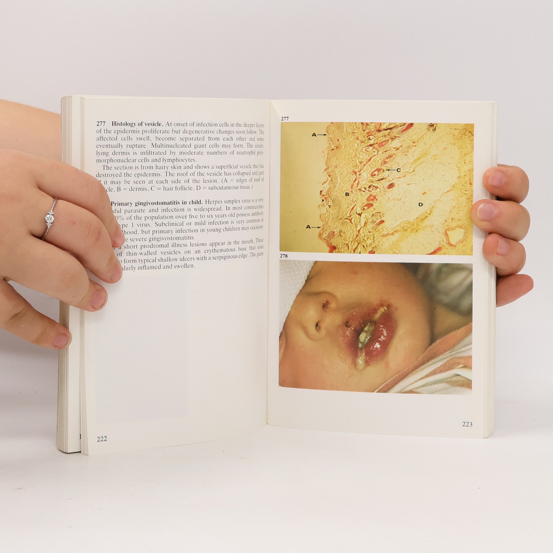 Ronald T. D. Emond Wolfe Medical Atlases: A Colour Atlas of Infectious Diseases