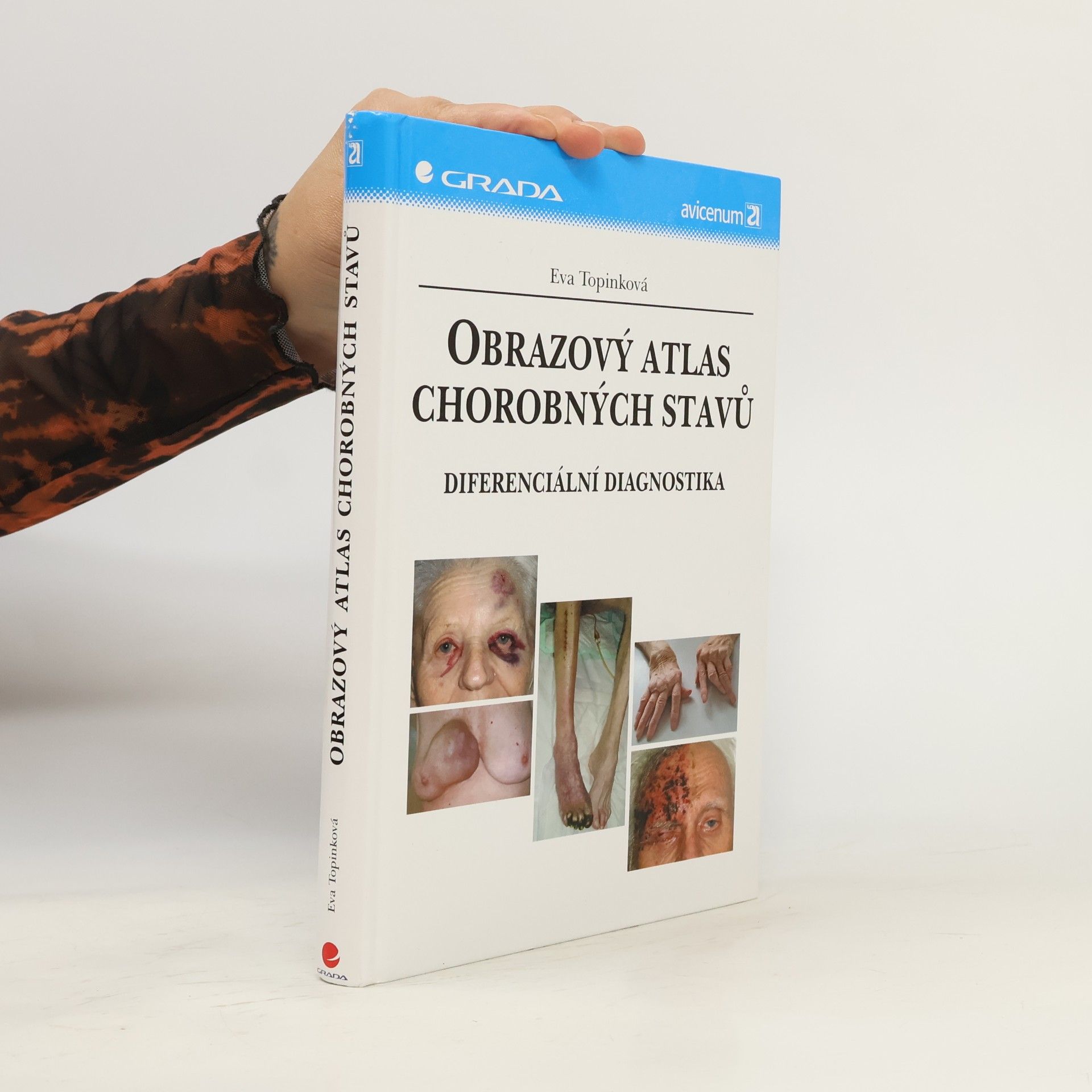 Eva Topinková Obrazový atlas chorobných stavů : diferenciální diagnostika