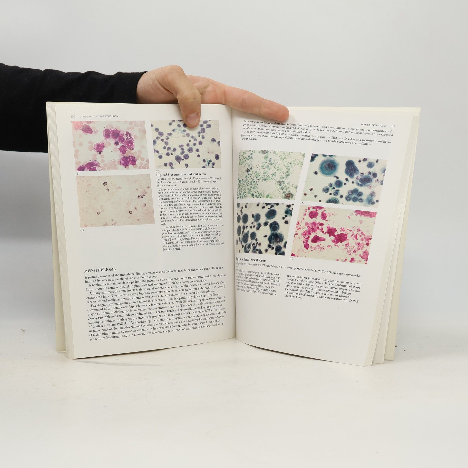 Chandra Grubb Diagnostic Cytopathology