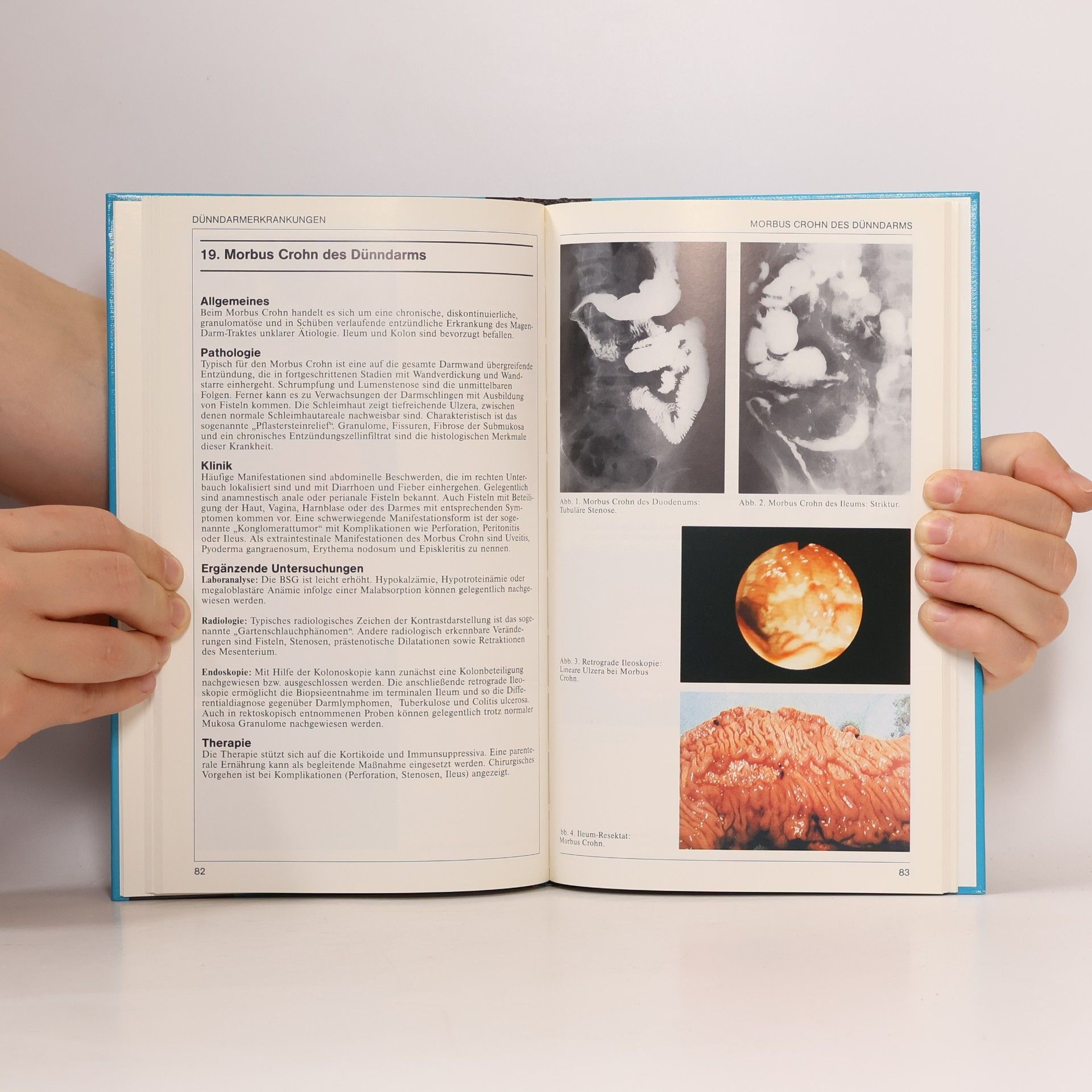 Jaume Boix Valverde Gastroenterologie