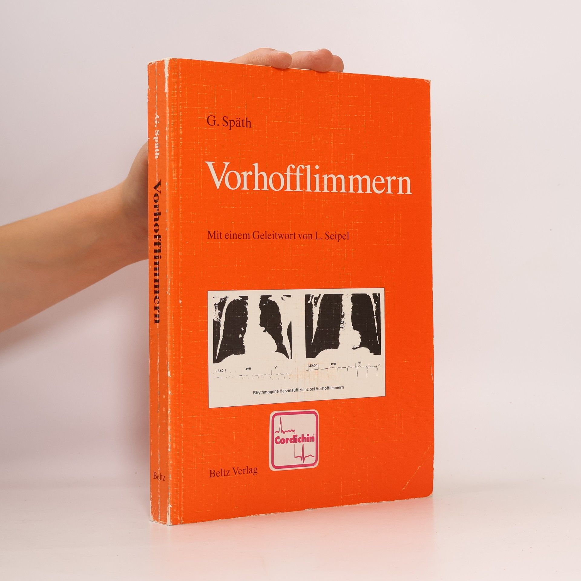 Gudrun Späth Vorhofflimmern