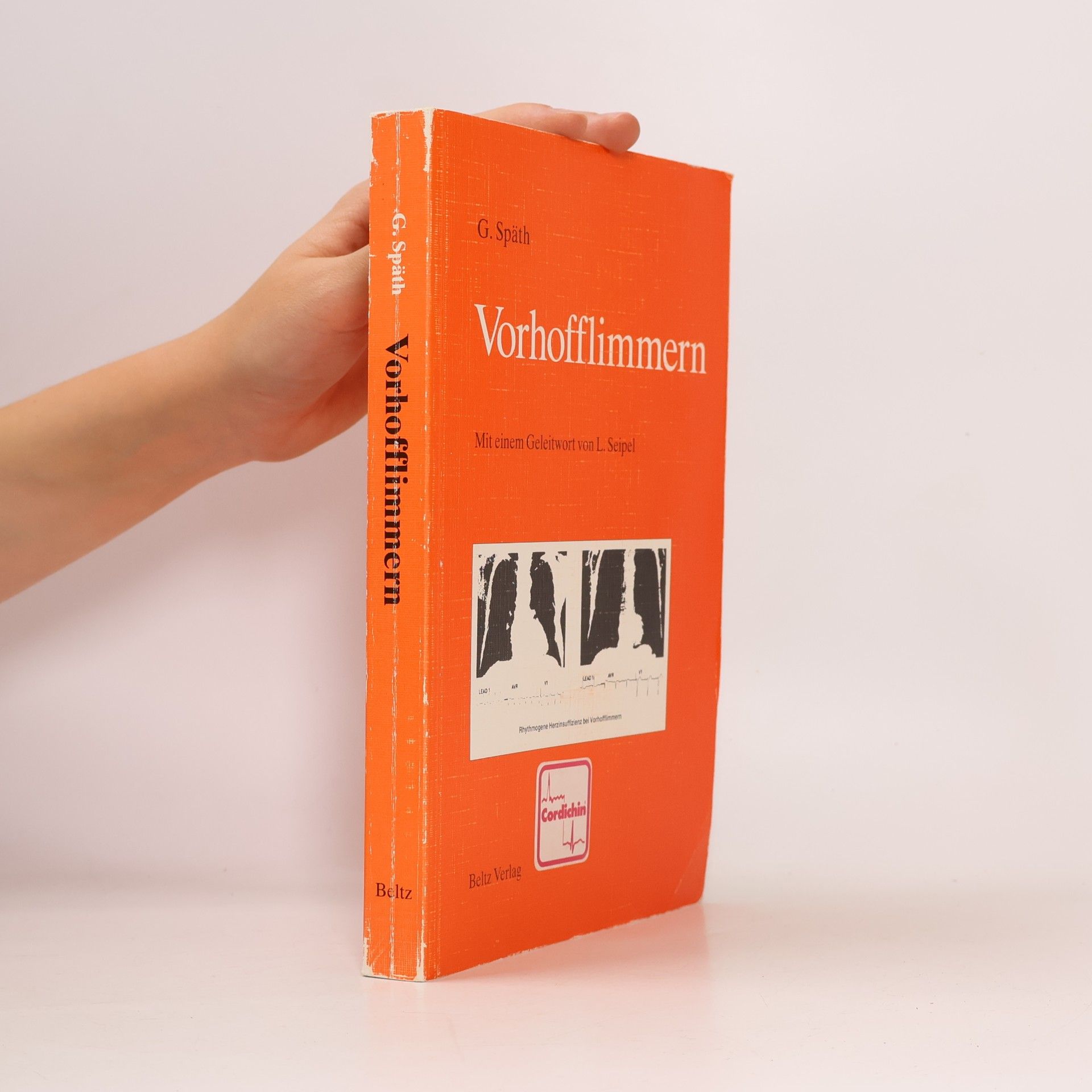 Gudrun Späth Vorhofflimmern
