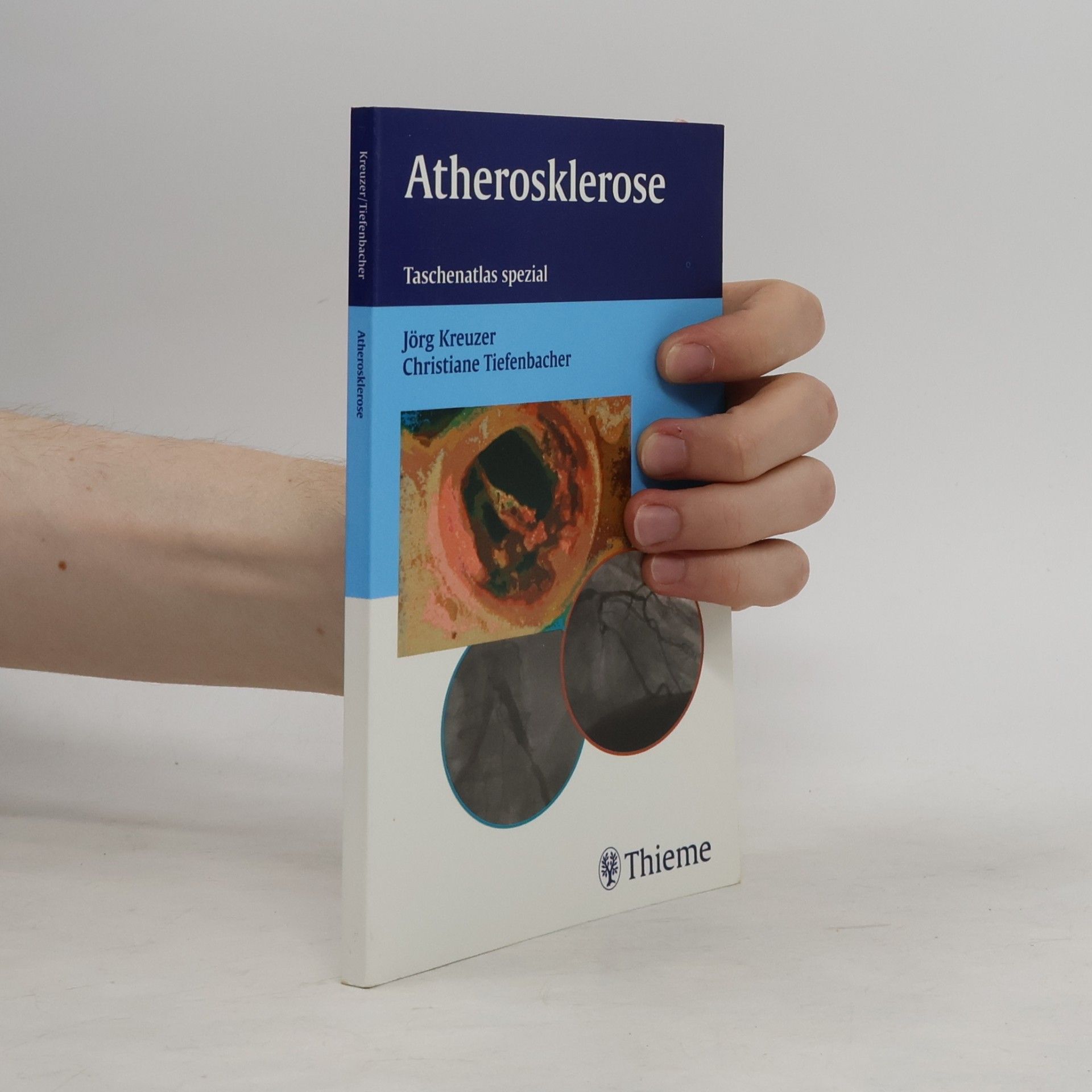 Atherosklerose