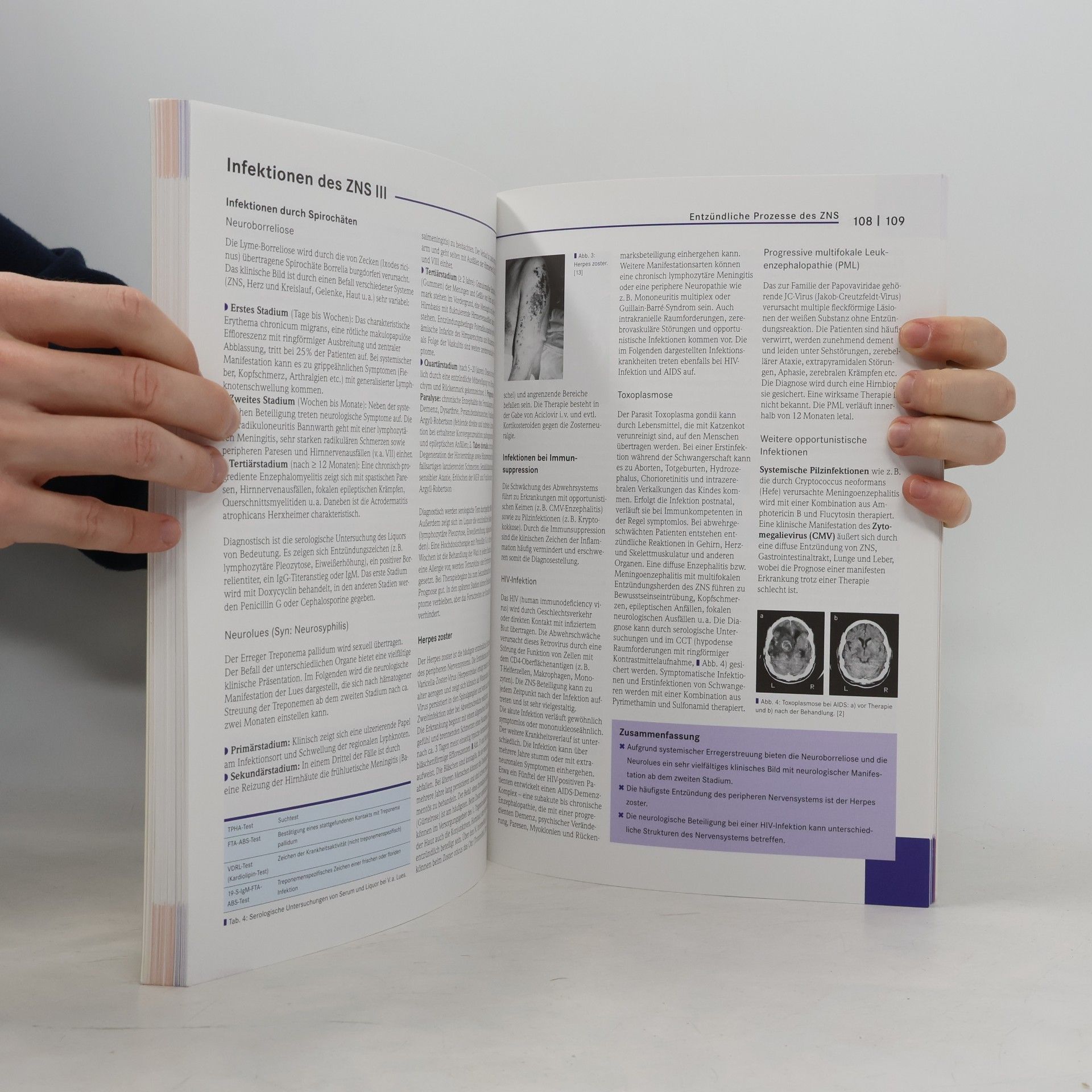 Marija Pinto Basics Neurologie