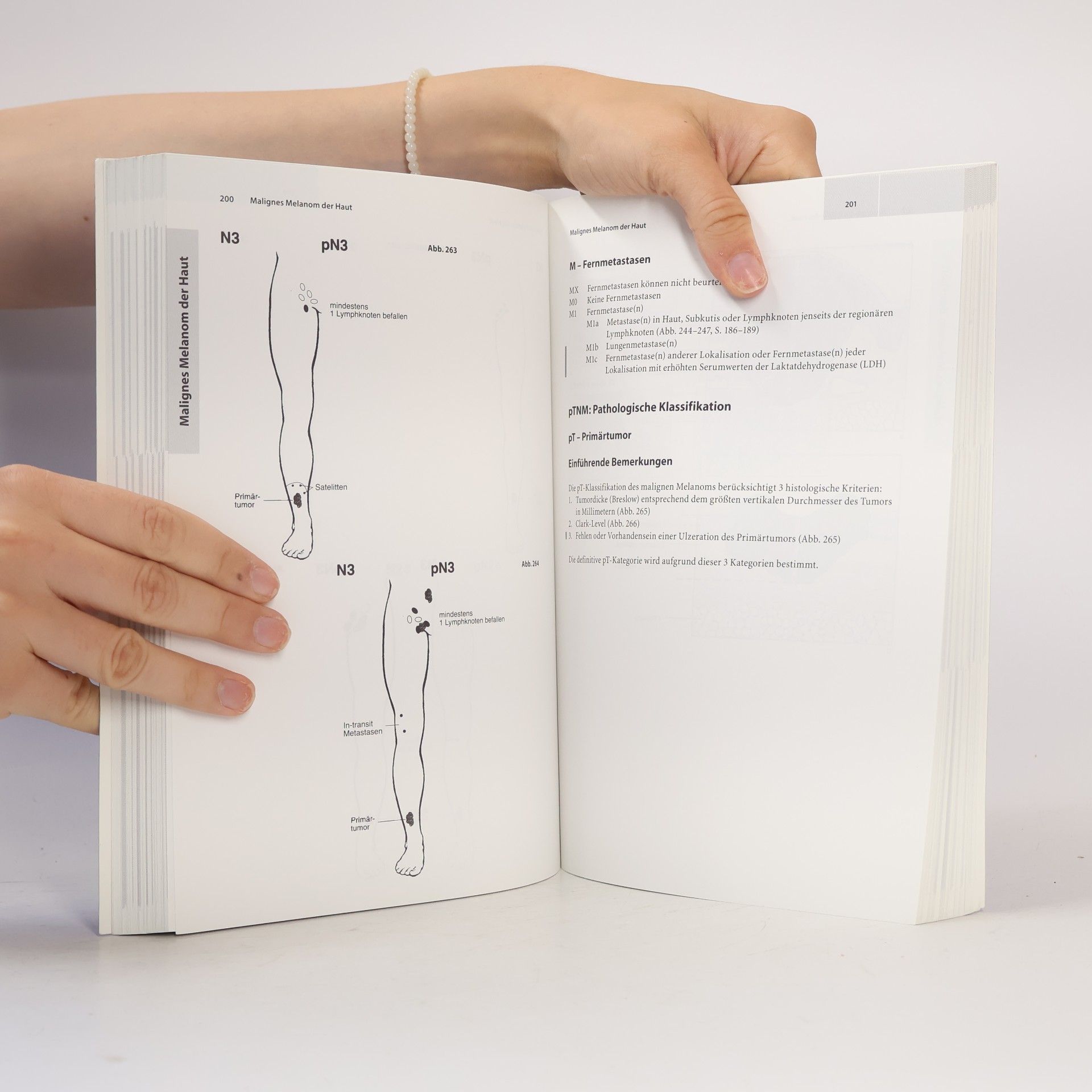 Christian F. Wittekind TNM-Atlas