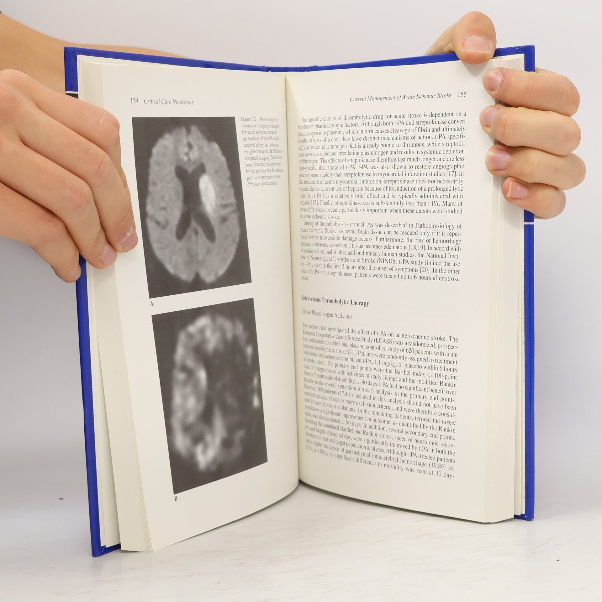 Eric C. Raps MD Critical Care Neurology