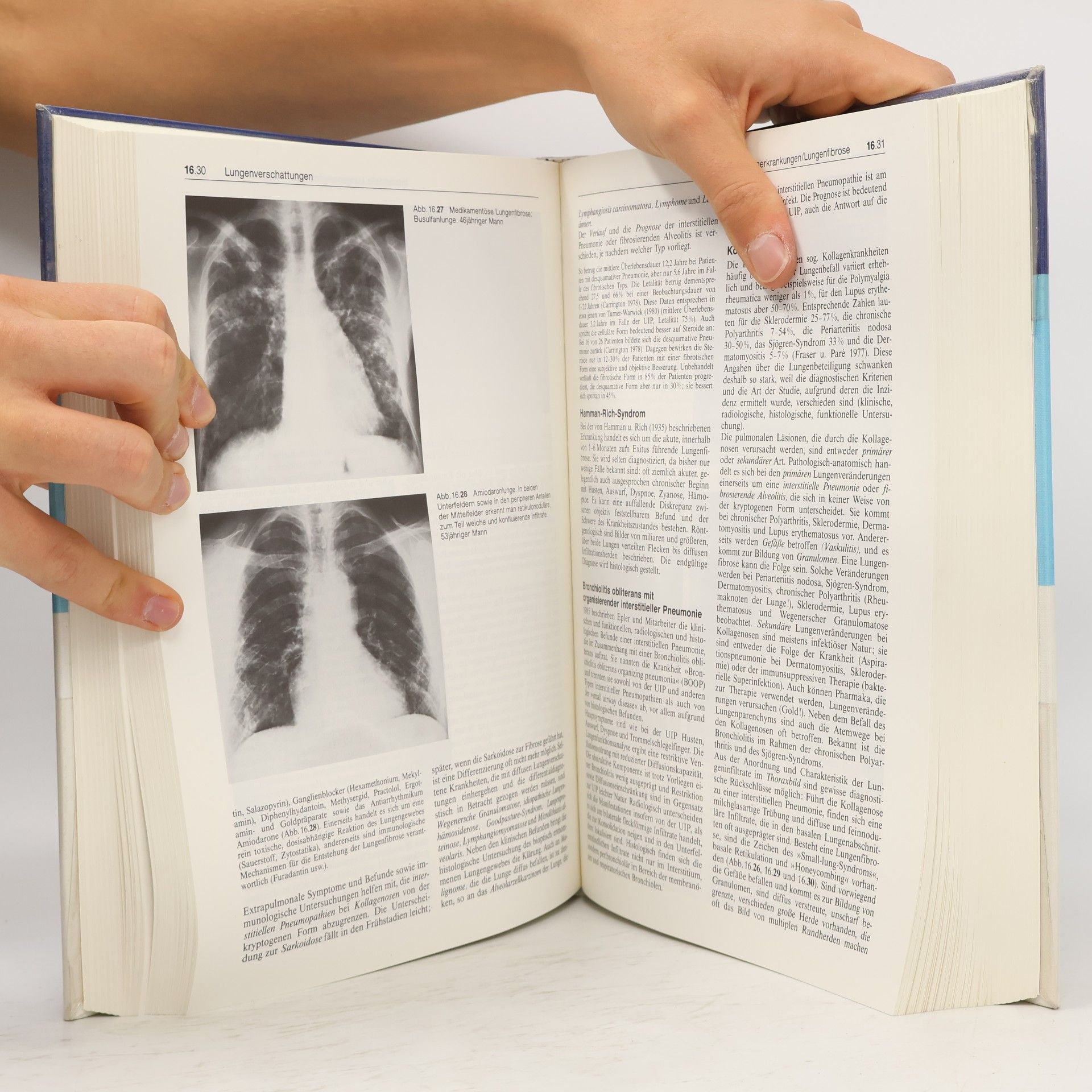 Walter Siegenthaler Differentialdiagnose innerer Krankheiten