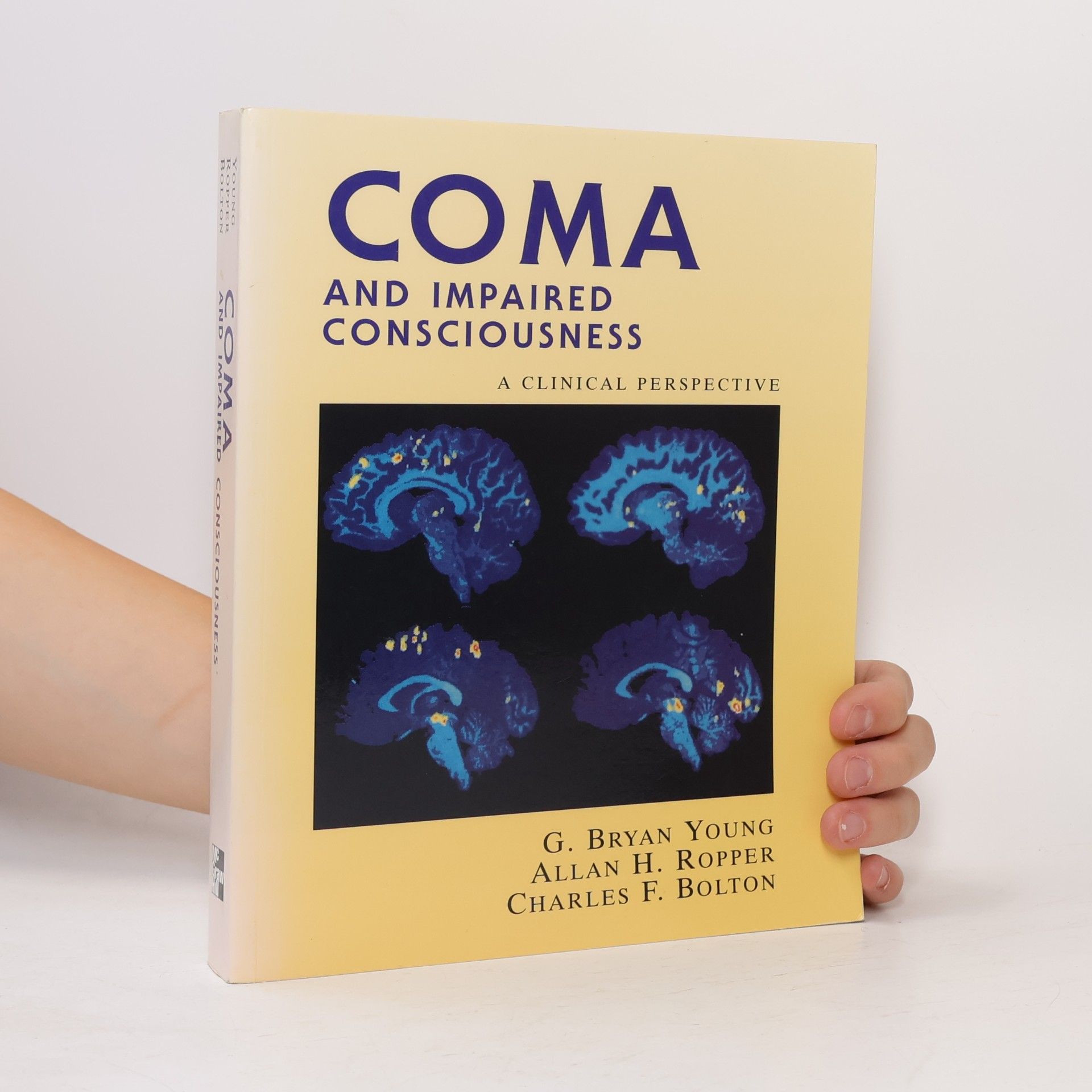 Coma and Impaired Consciousness