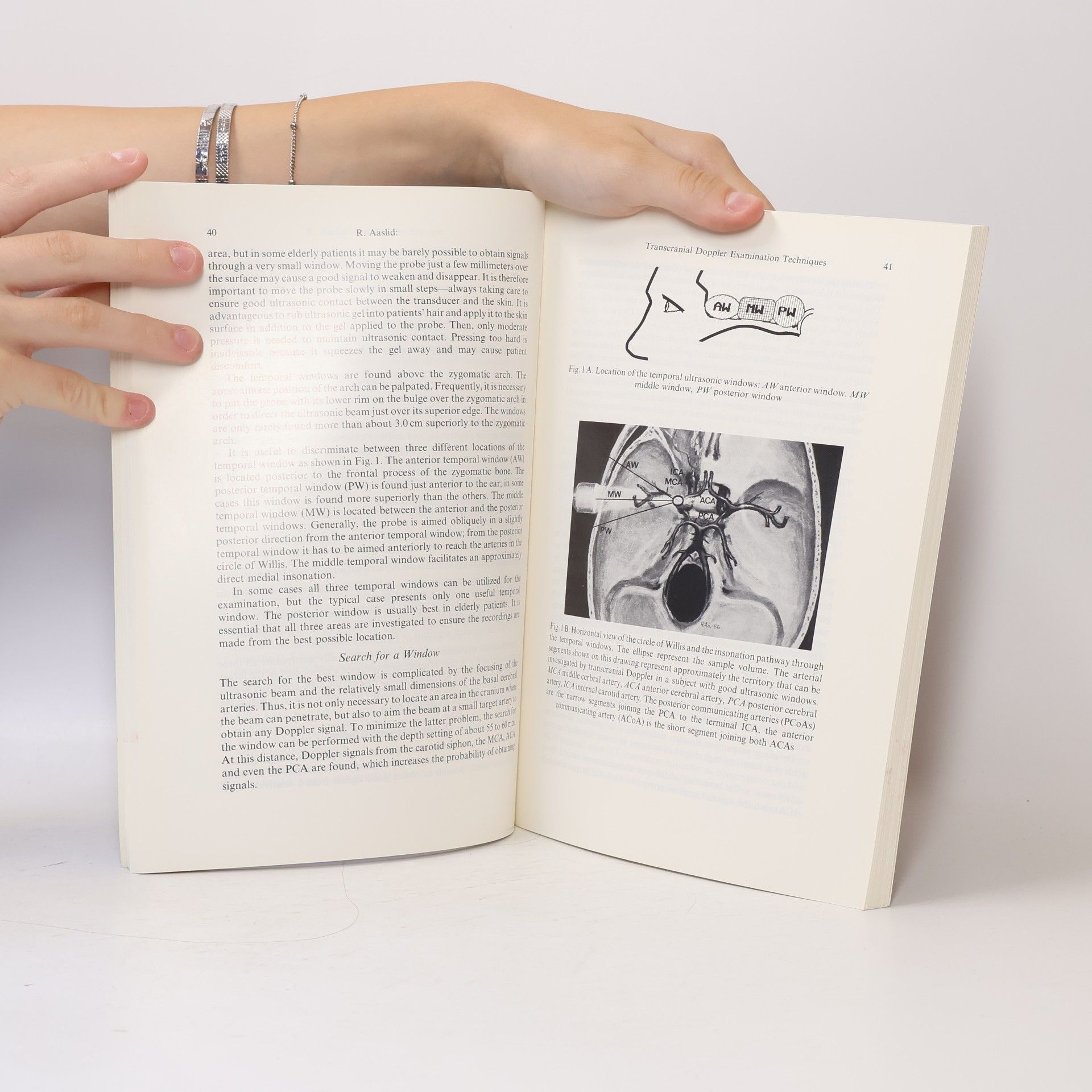 Rune Aaslid Transcranial Doppler Sonography