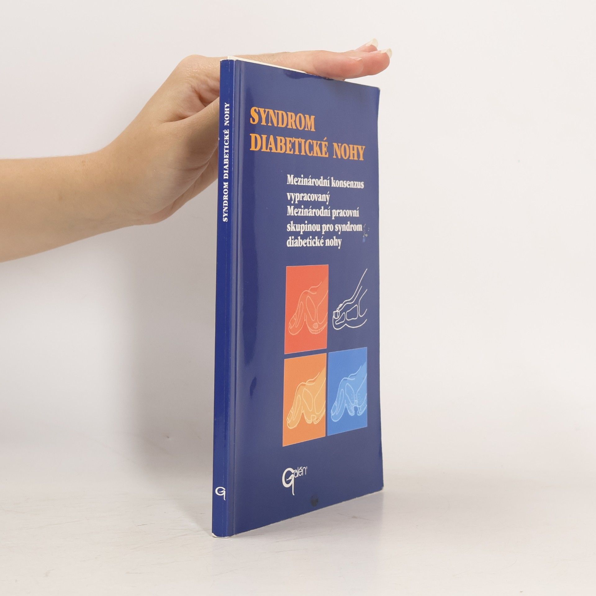 Auteurscollectief Syndrom diabetické nohy