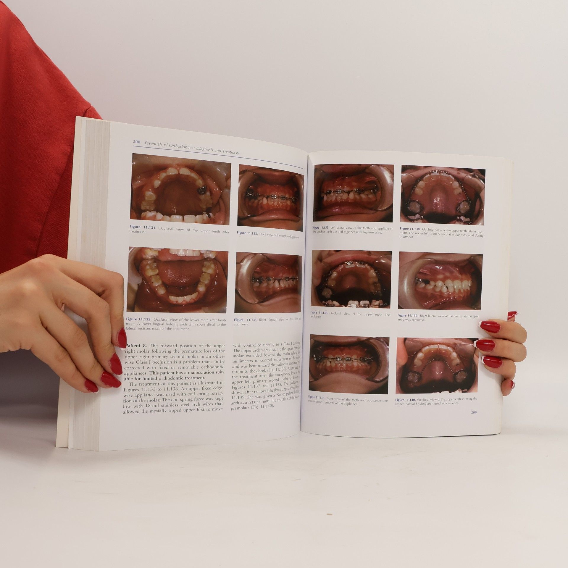 Robert N. Staley Essentials of Orthodontics