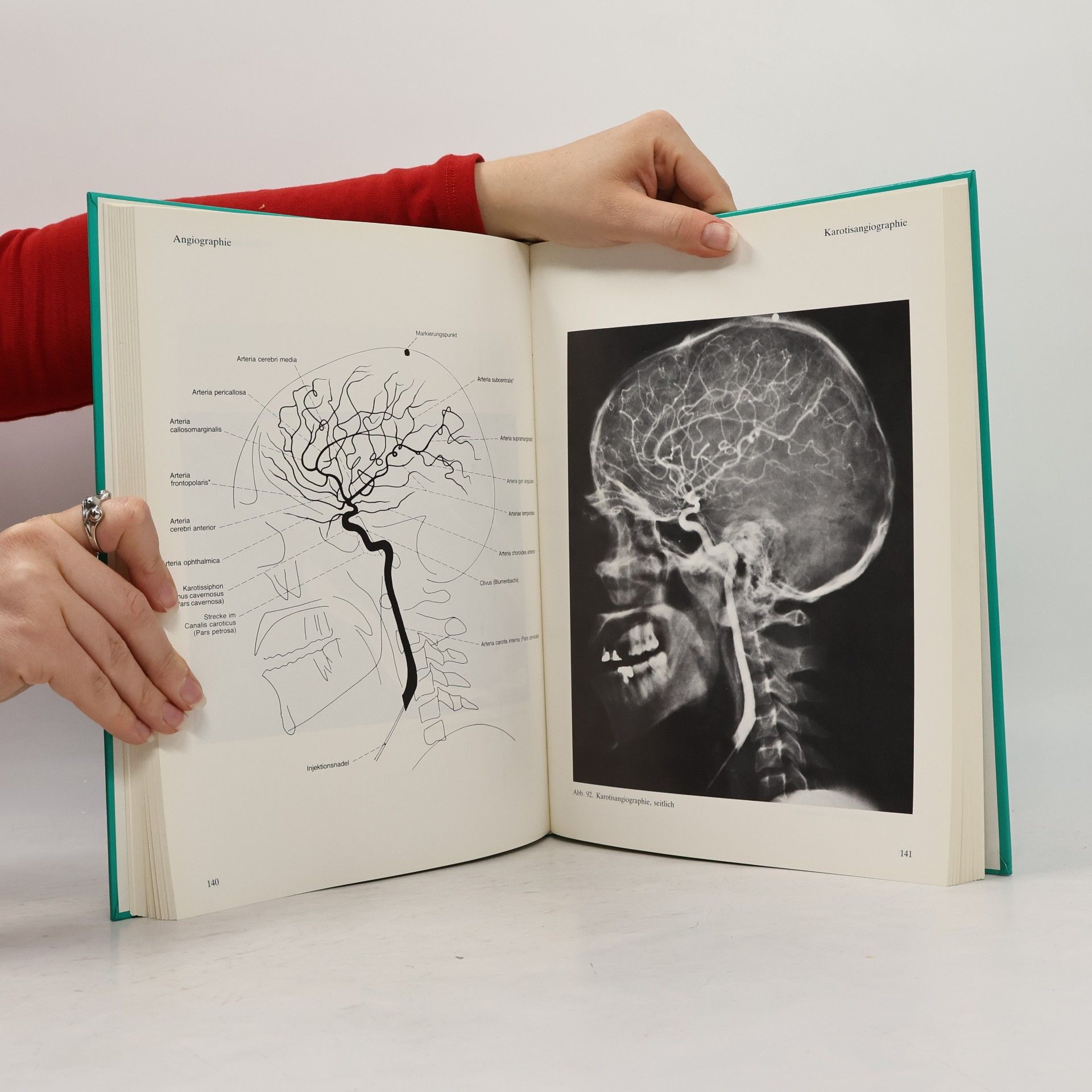 Lothar Wicke Röntgen-Anatomie