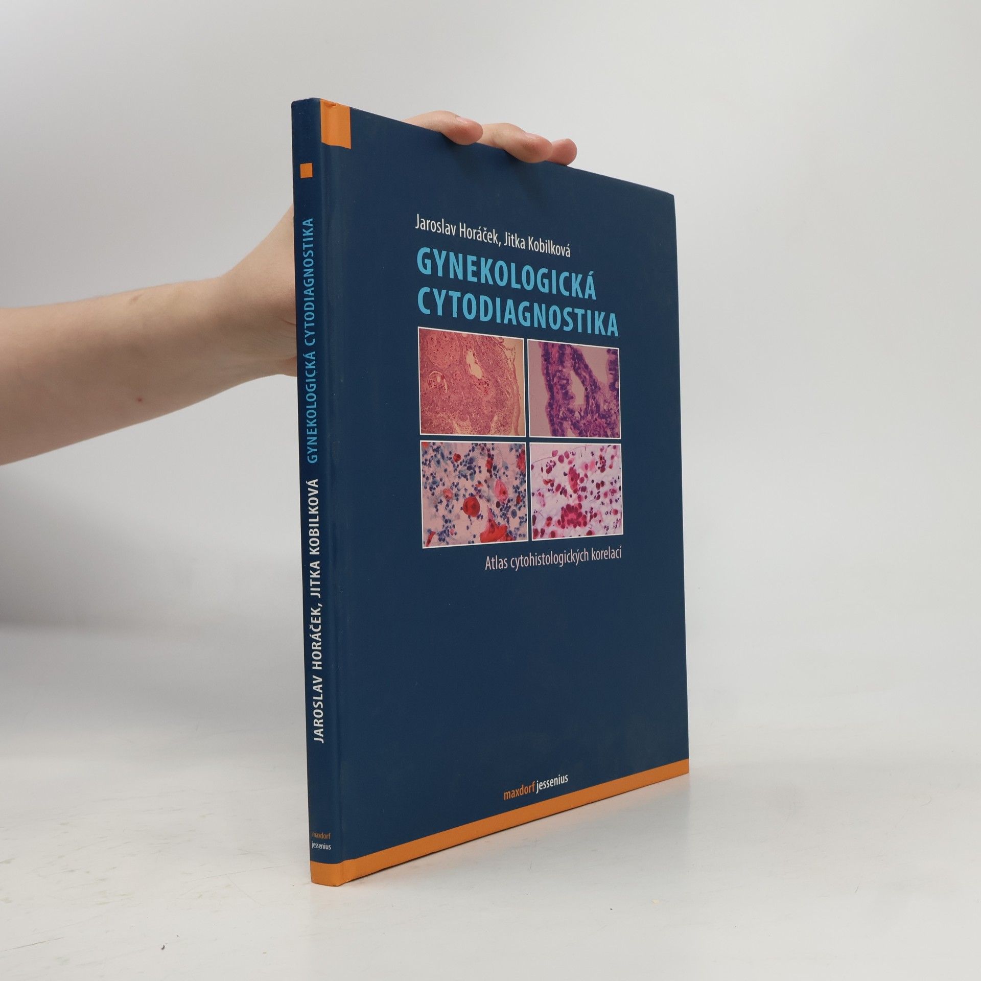 Jaroslav Horáček Gynekologická cytodiagnostika: Atlas cytohistologických korelací