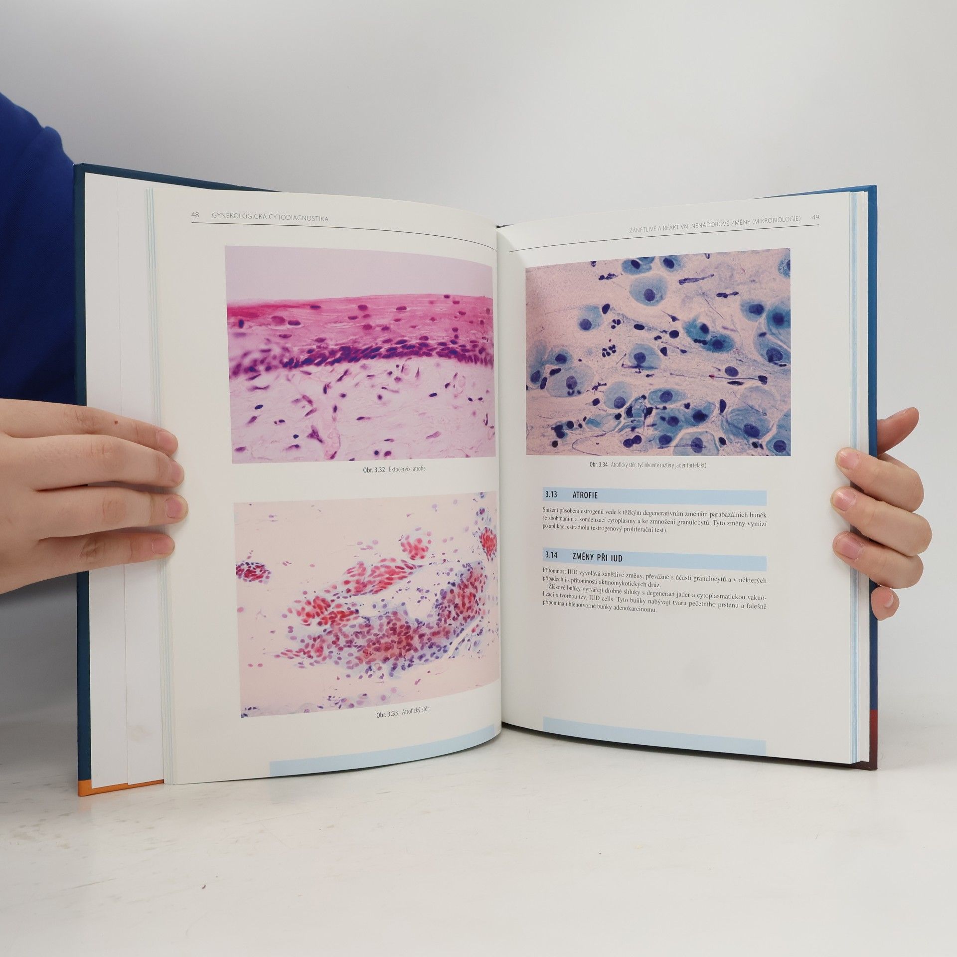 Jaroslav Horáček Gynekologická cytodiagnostika: Atlas cytohistologických korelací