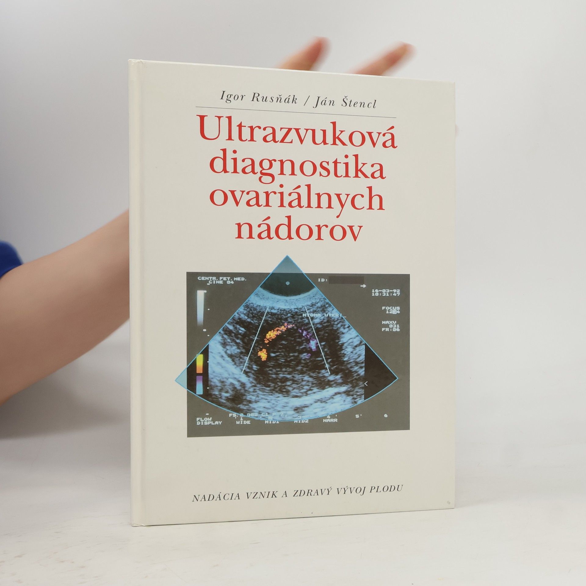 Igor Rusňák Ultrazvuková diagnostika ovariálnych nádorov