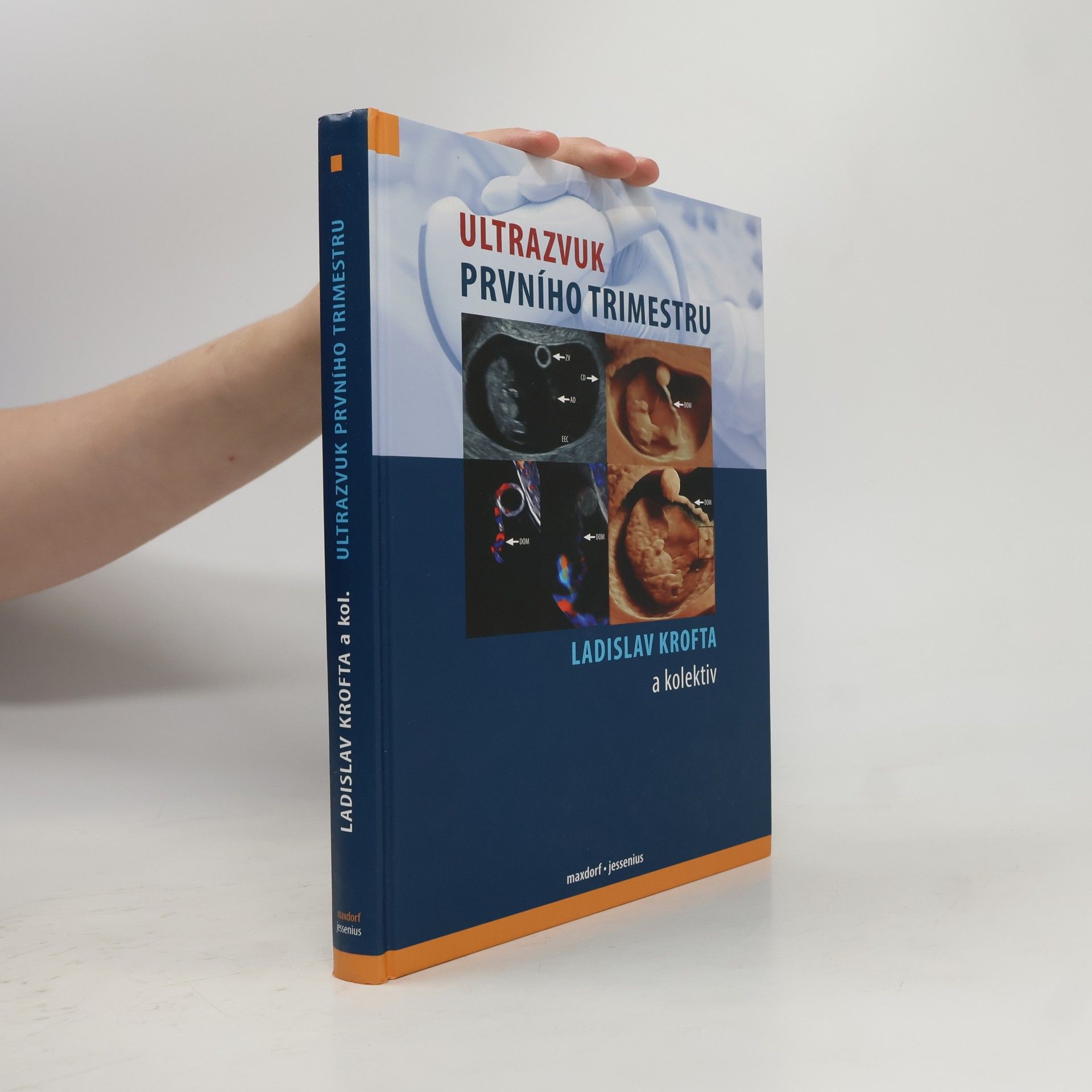 Ladislav Krofta Ultrazvuk prvního trimestru