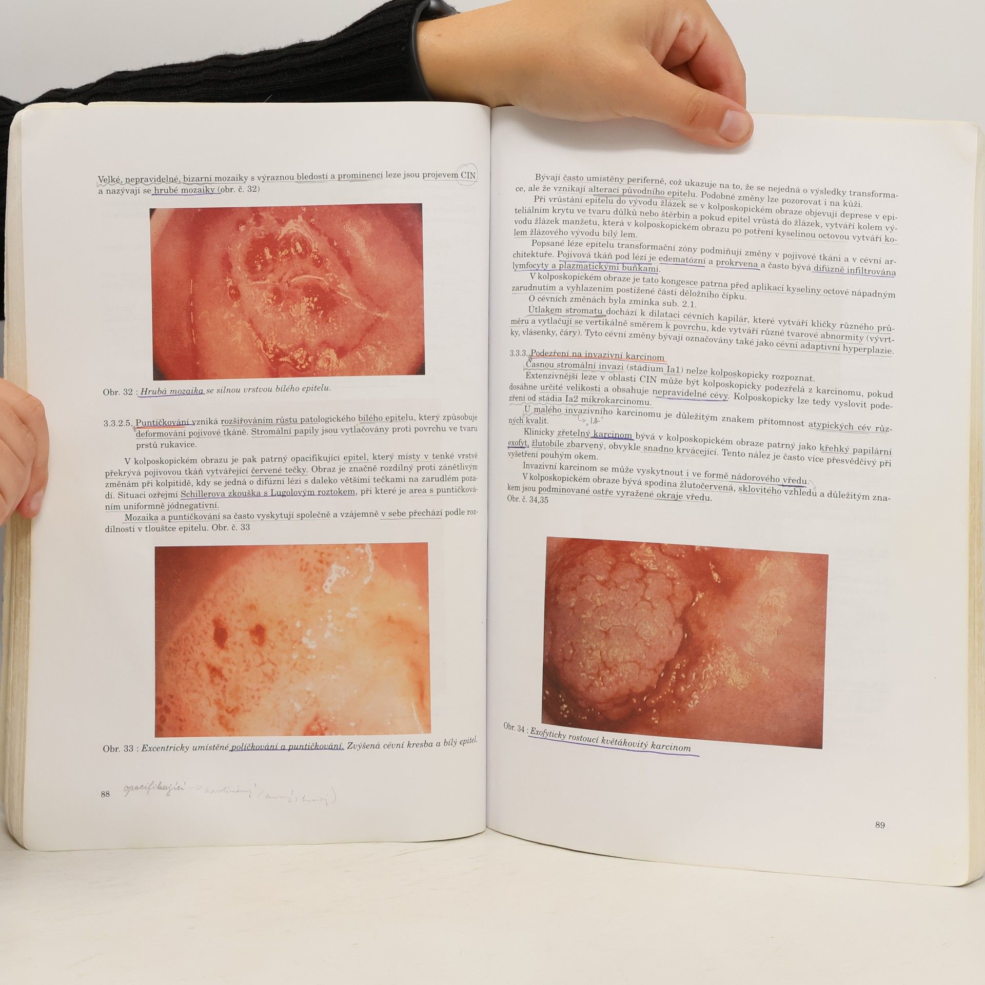 Aleš Roztočil Vyšetřovací metody v gynekologii a porodnictví