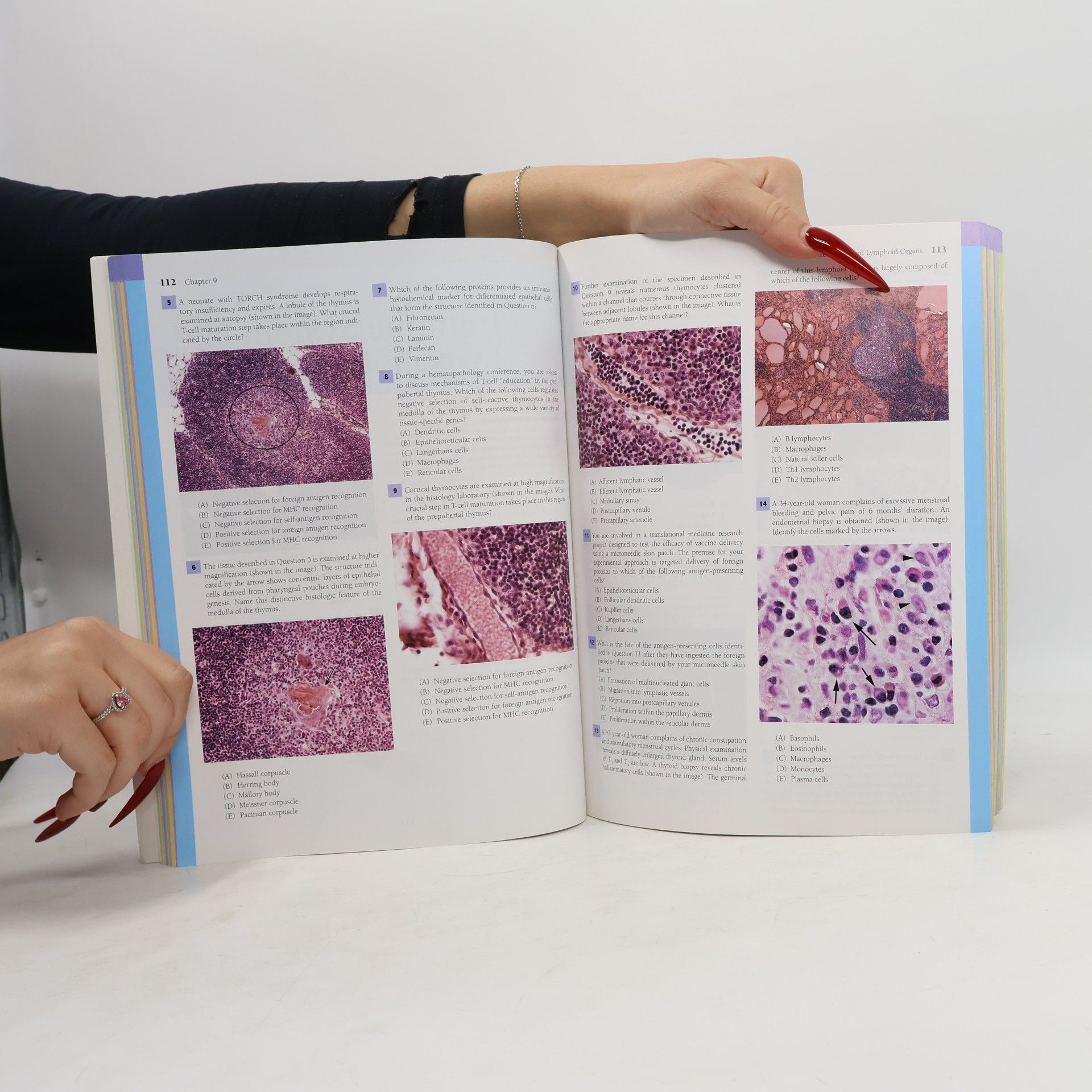 Bruce A. Fenderson Lippincott's Illustrated Q&A Review of Histology