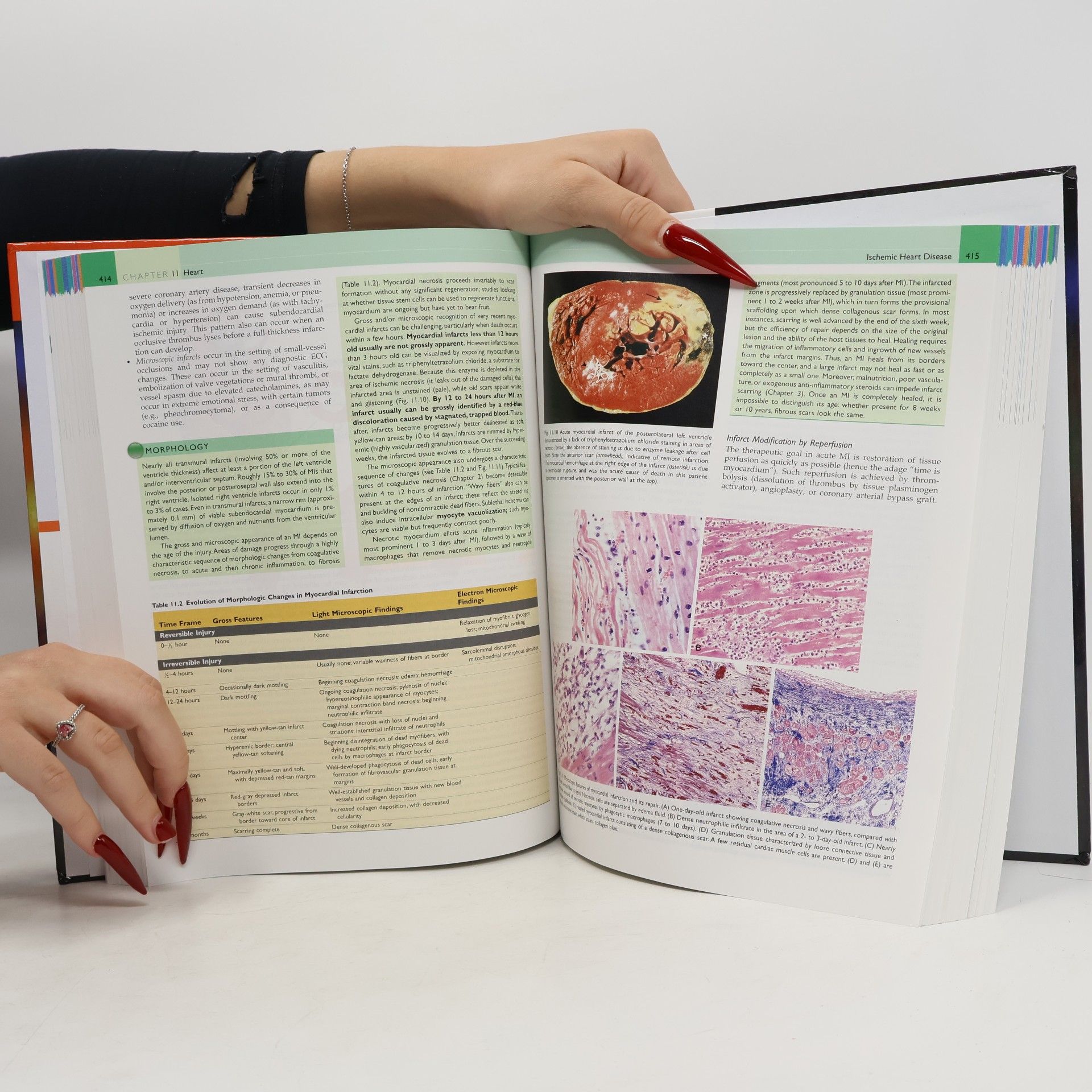 Viay Kumar Robbins Basic Pathology