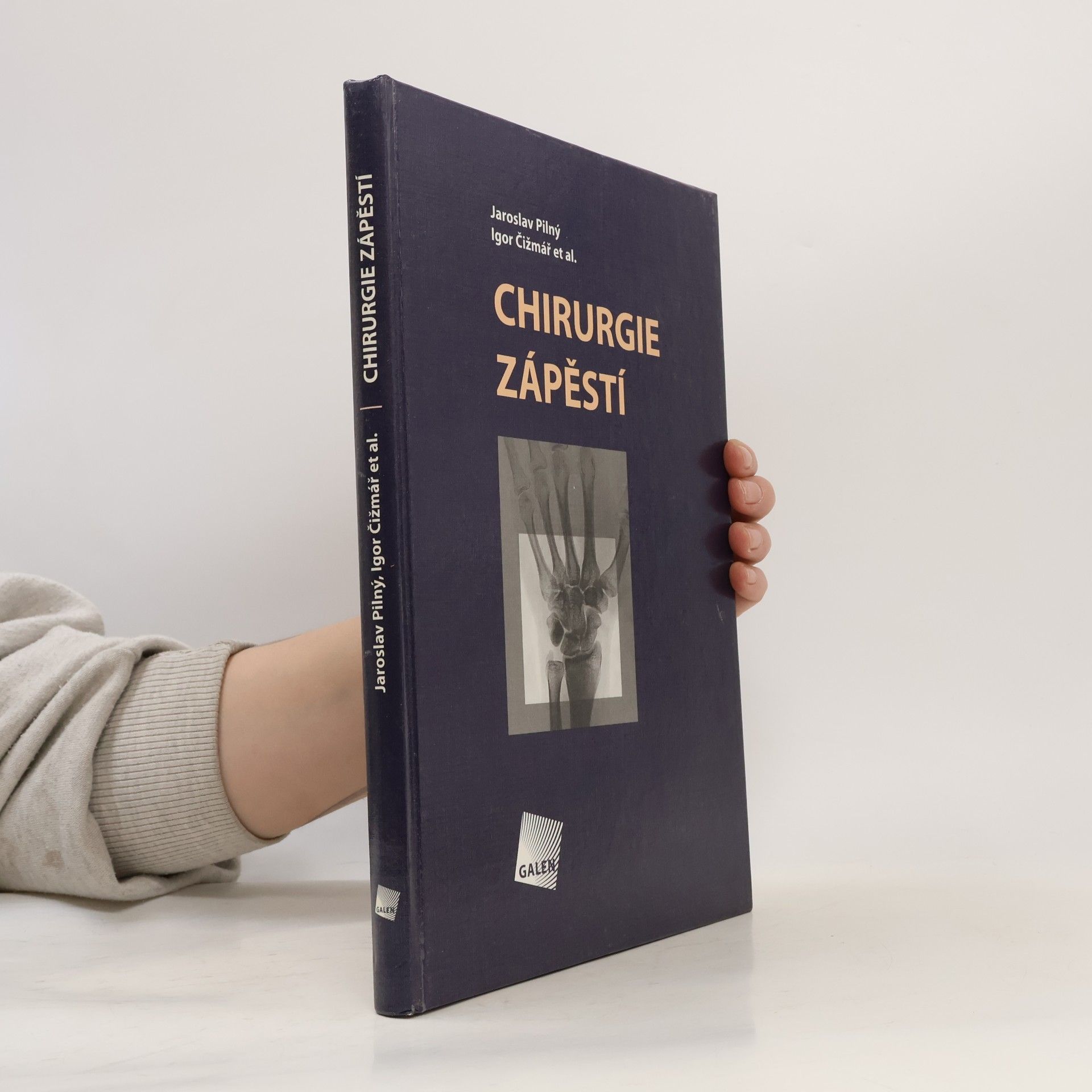 Igor Čižmář Chirurgie zápěstí