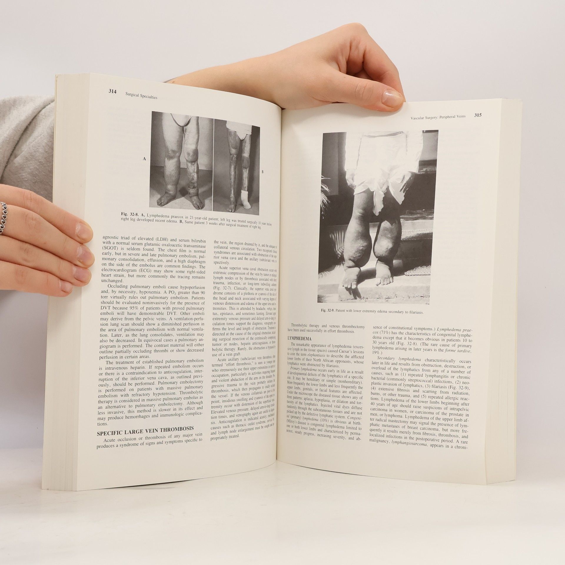 Richard D Liechty Fundamentals of Surgery