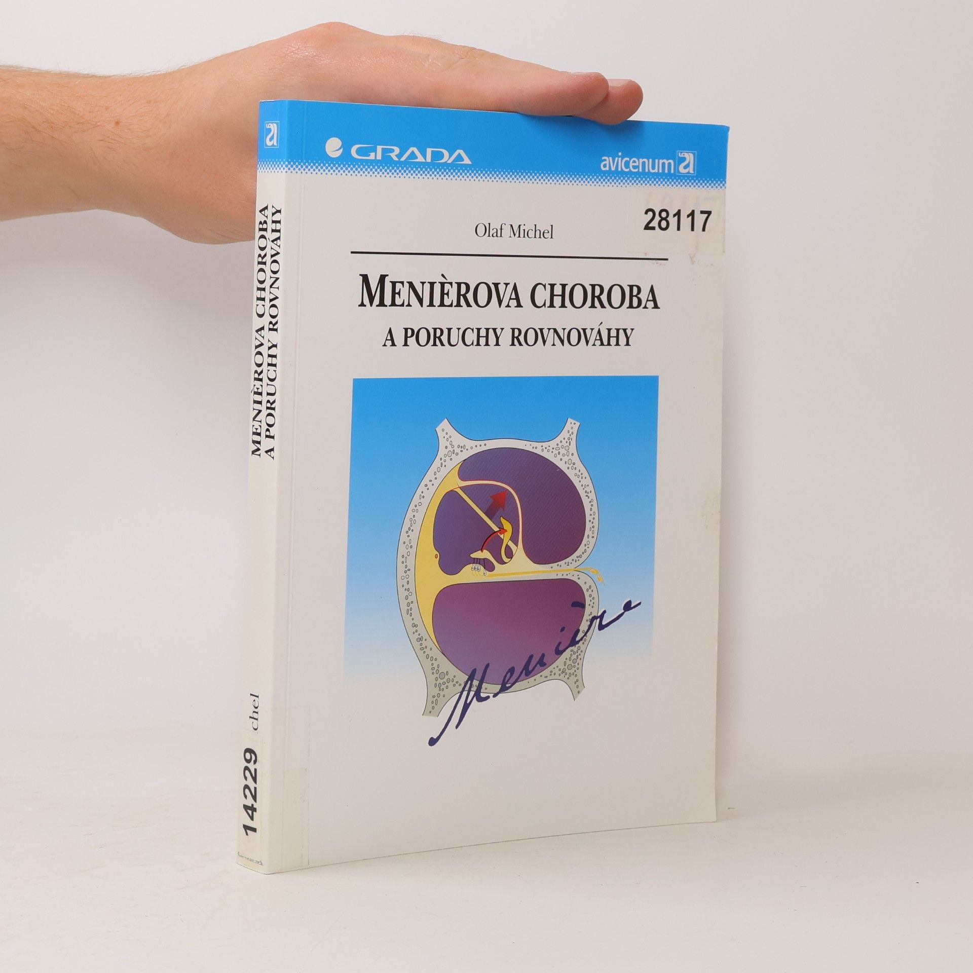 Michel Olaf Meniérova choroba a poruchy rovnováhy