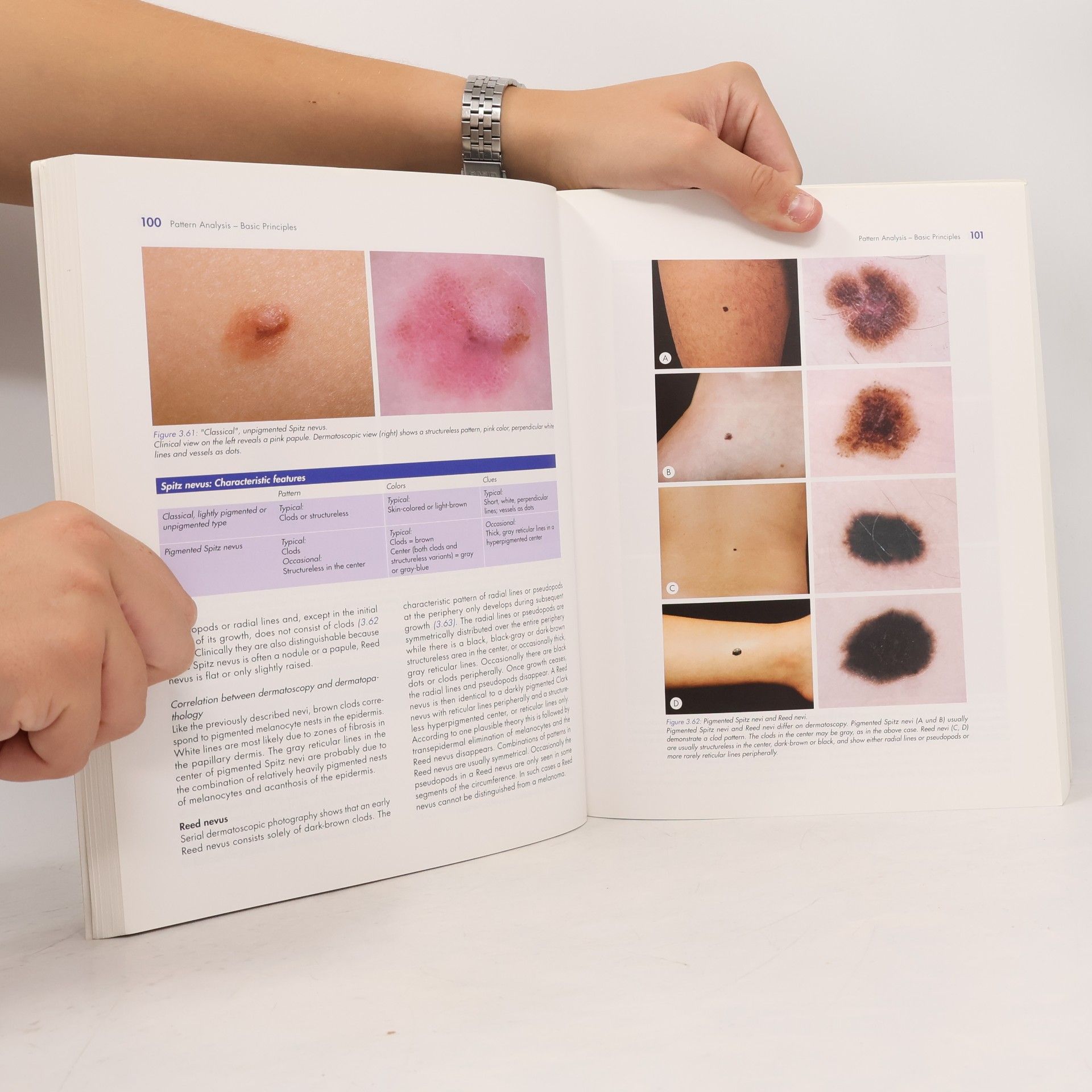 Harald Kittler Dermatoscopy