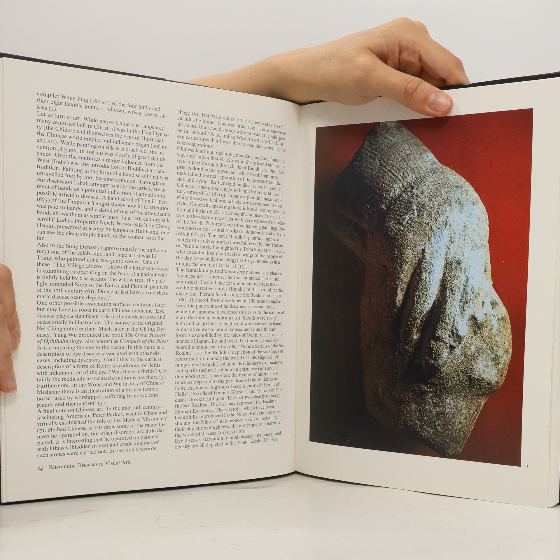 Autorenkollektiv Art, History and Antiquity of Rheumatic Diseases
