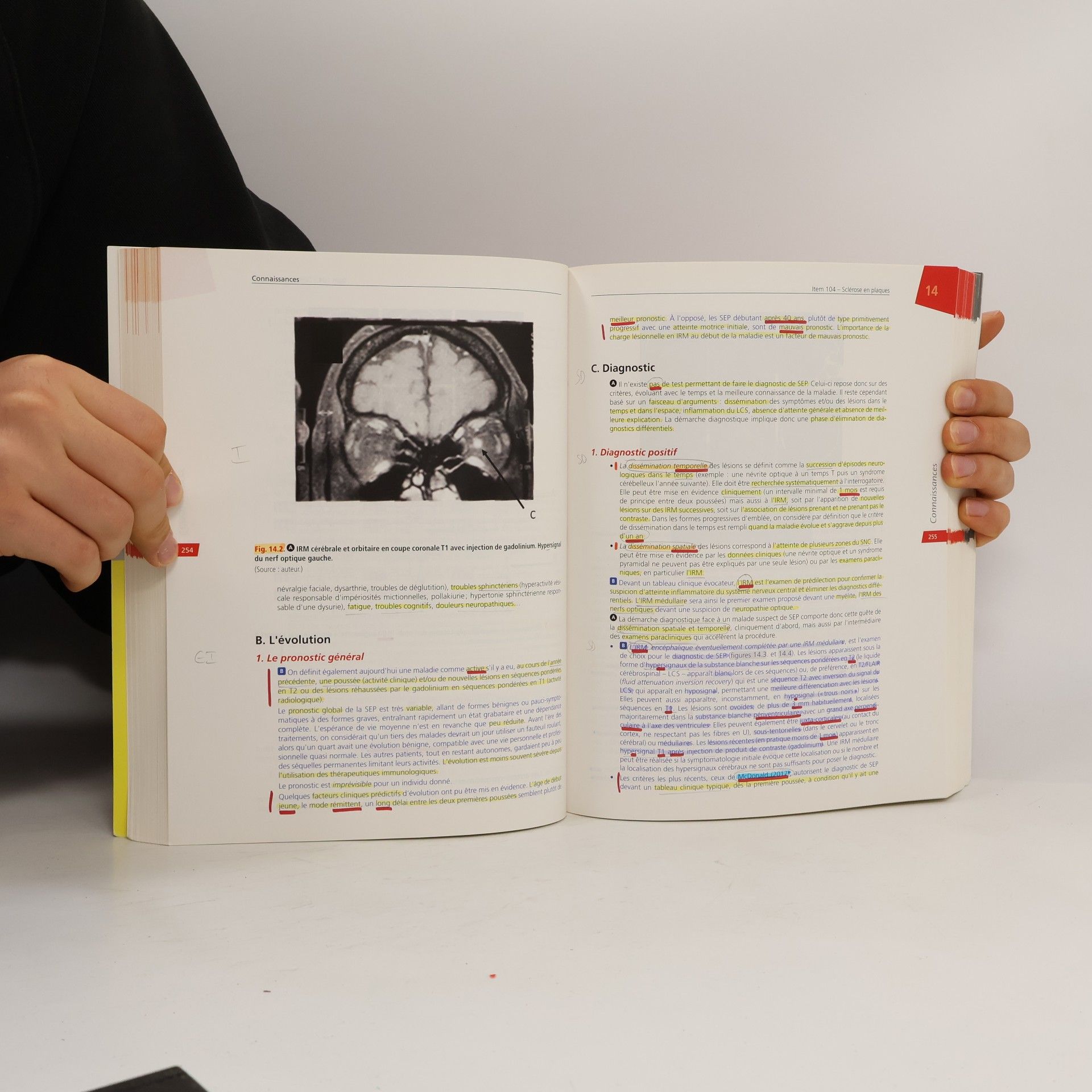 Collège des enseignants de neurologie Neurologie