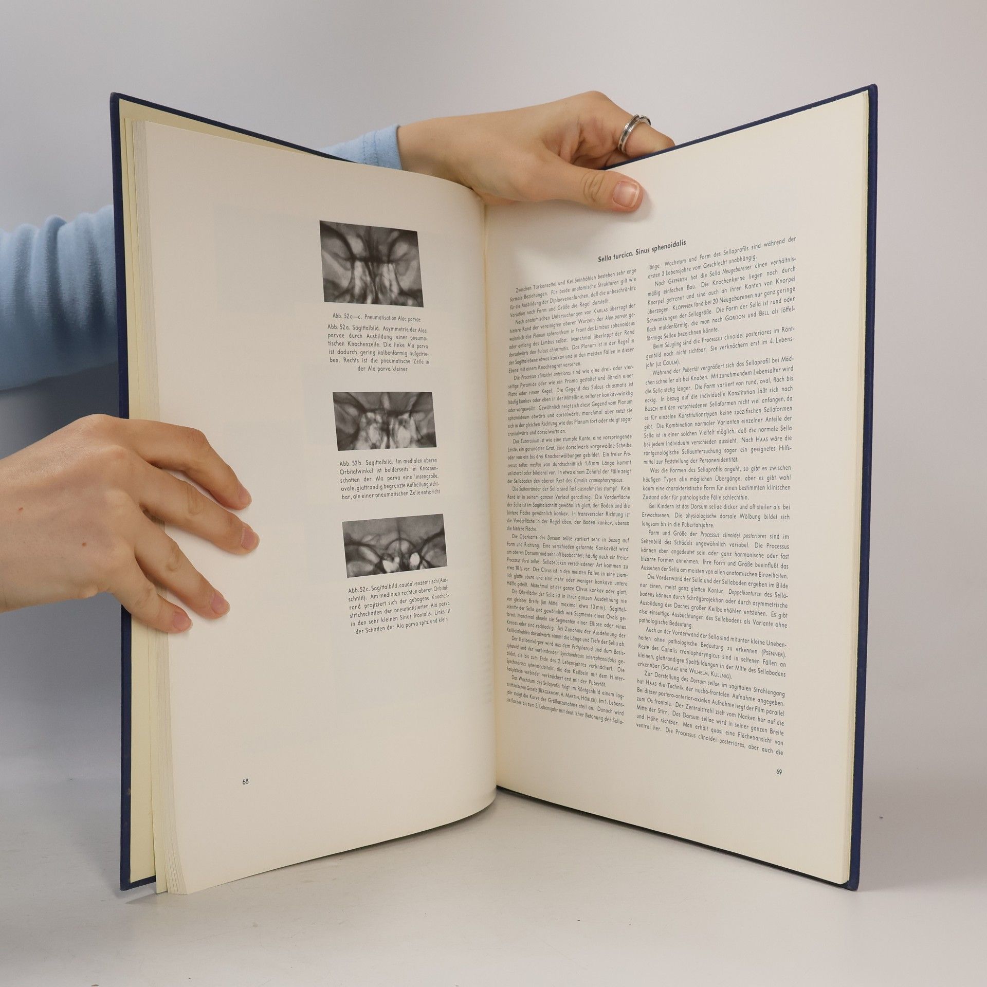 Walther Bergerhoff Atlas anatomischer Varianten des Schädels im Röntgenbild