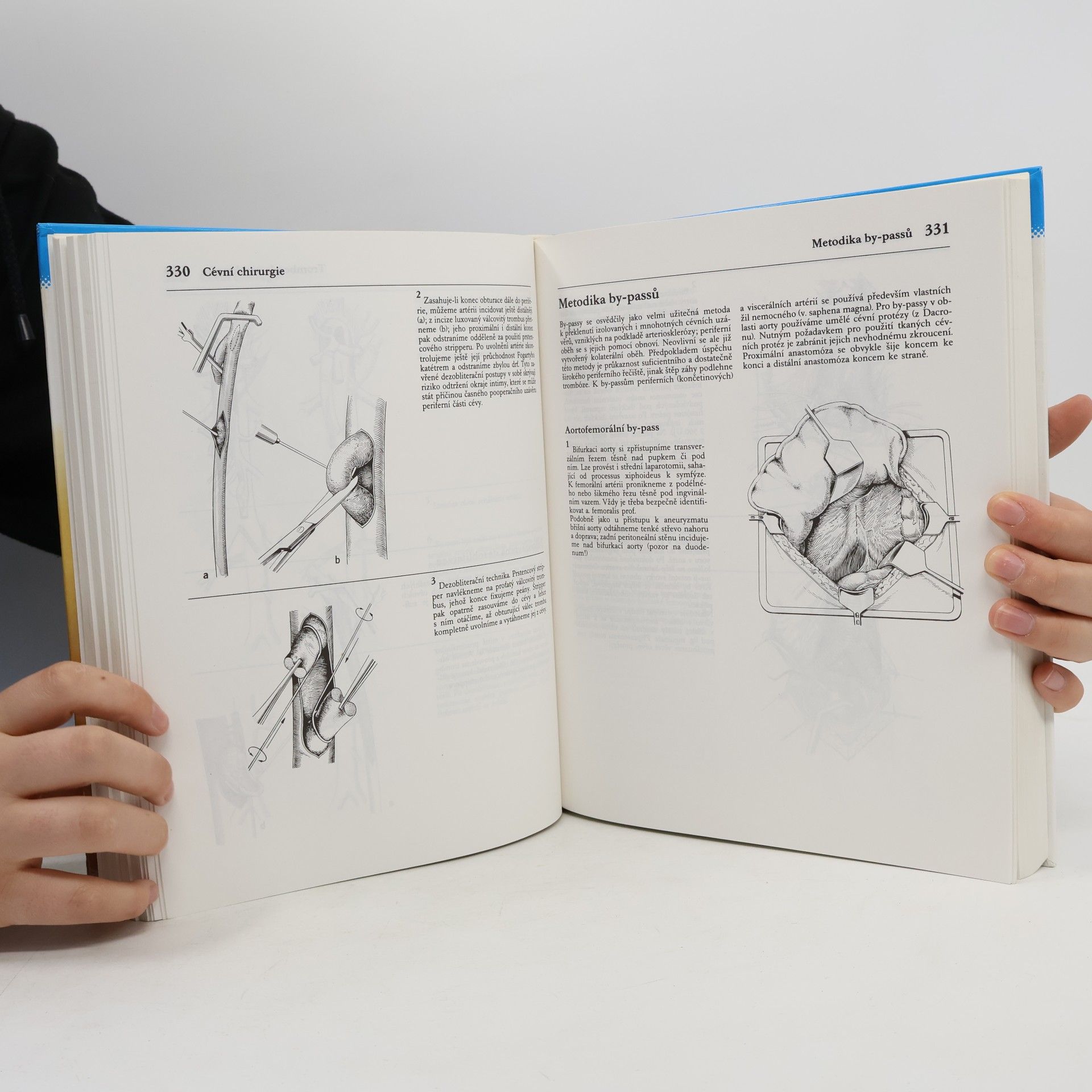 Horst Eberhard Grewe Atlas chirurgických operací