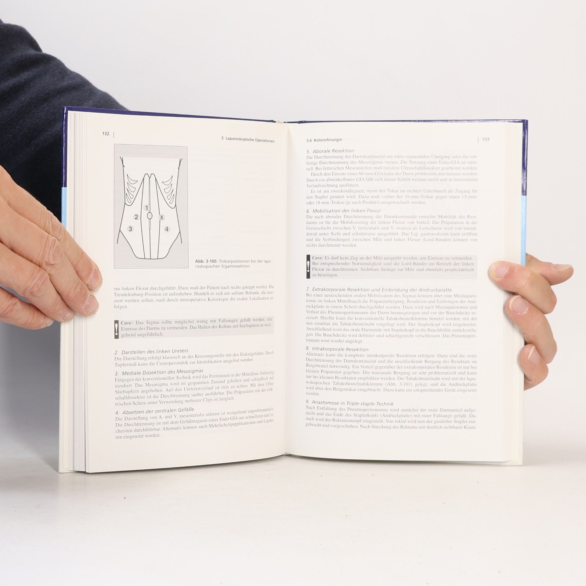 Rudolf Weiner Manual der laparoskopischen Chirurgie. Ein Ratgeber für den Chirurgen.