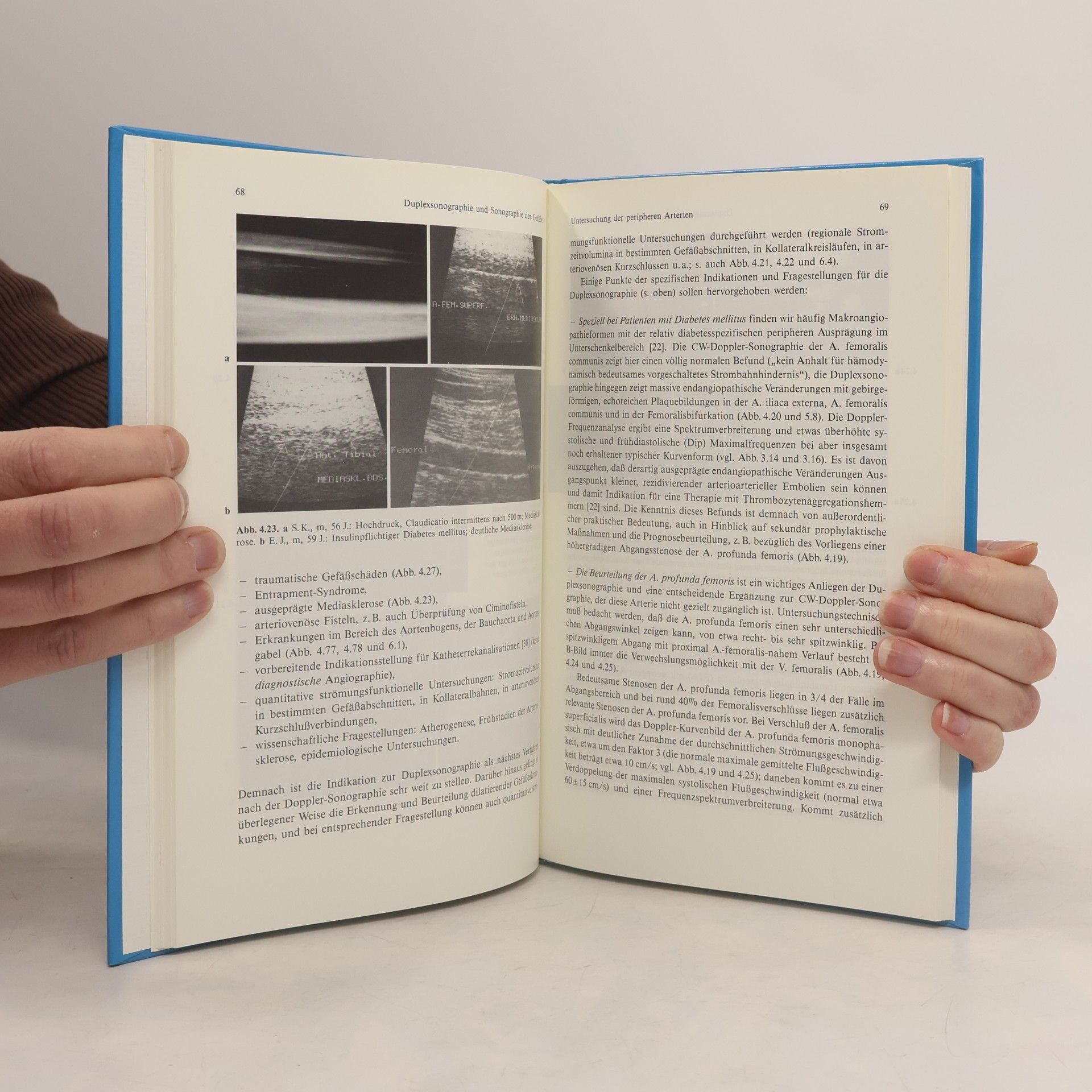 Markward Marshall Praktische Duplexsonographie