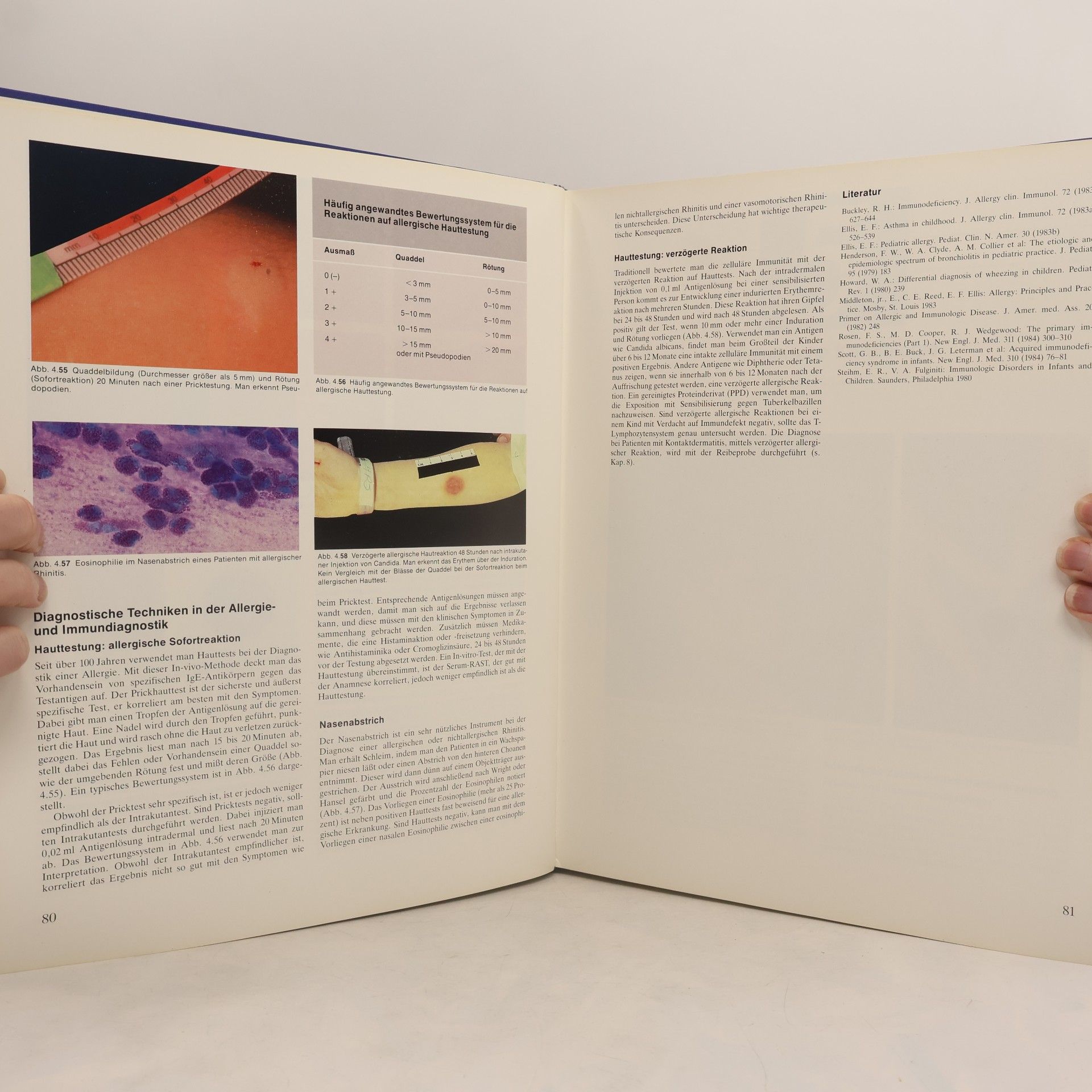 Basil J. Zitelli Farbatlas pädiatrischer Krankheitsbilder