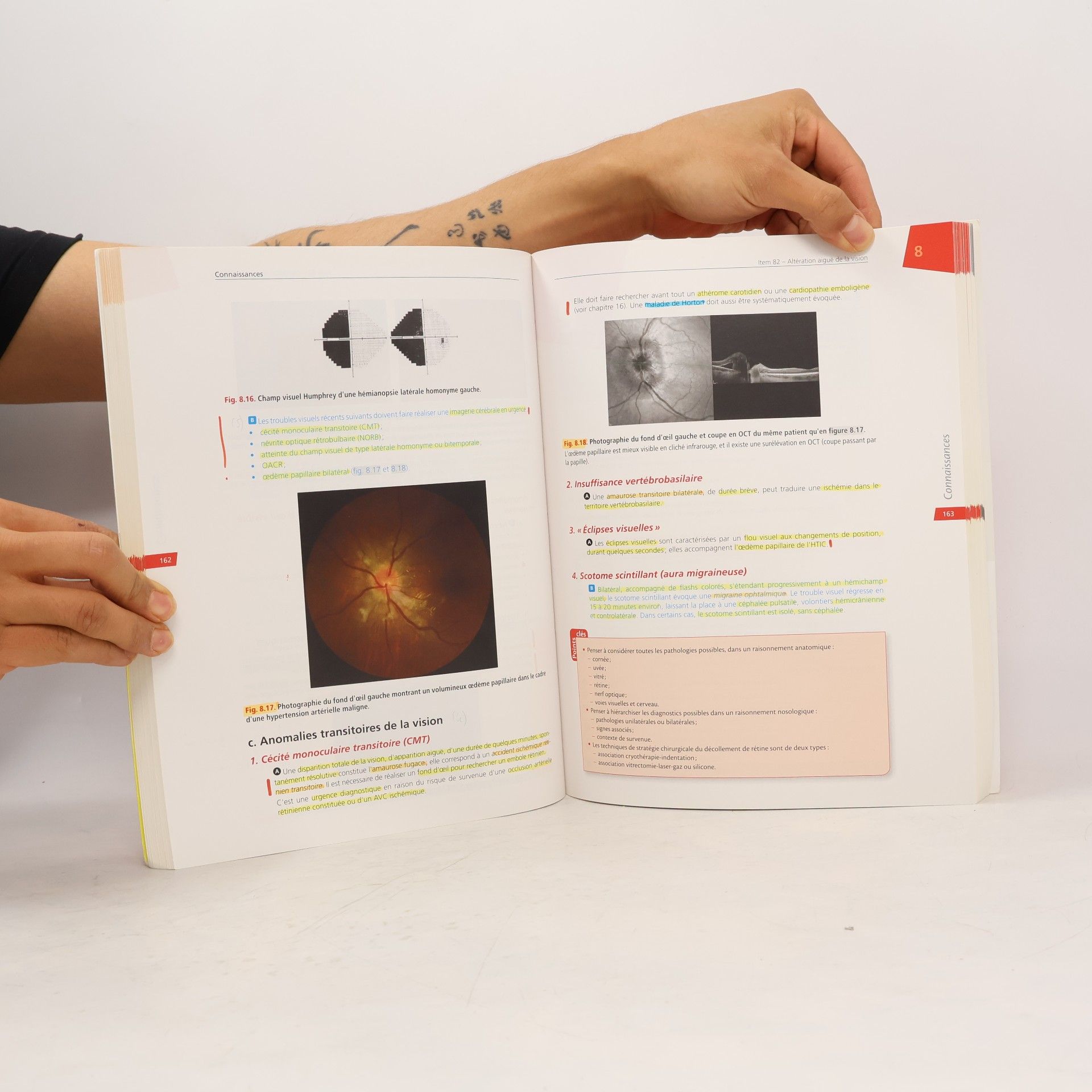 Collège des ophtalmologistes universitaires de France Les référentiels des Collèges - 5: Ophtalmologie