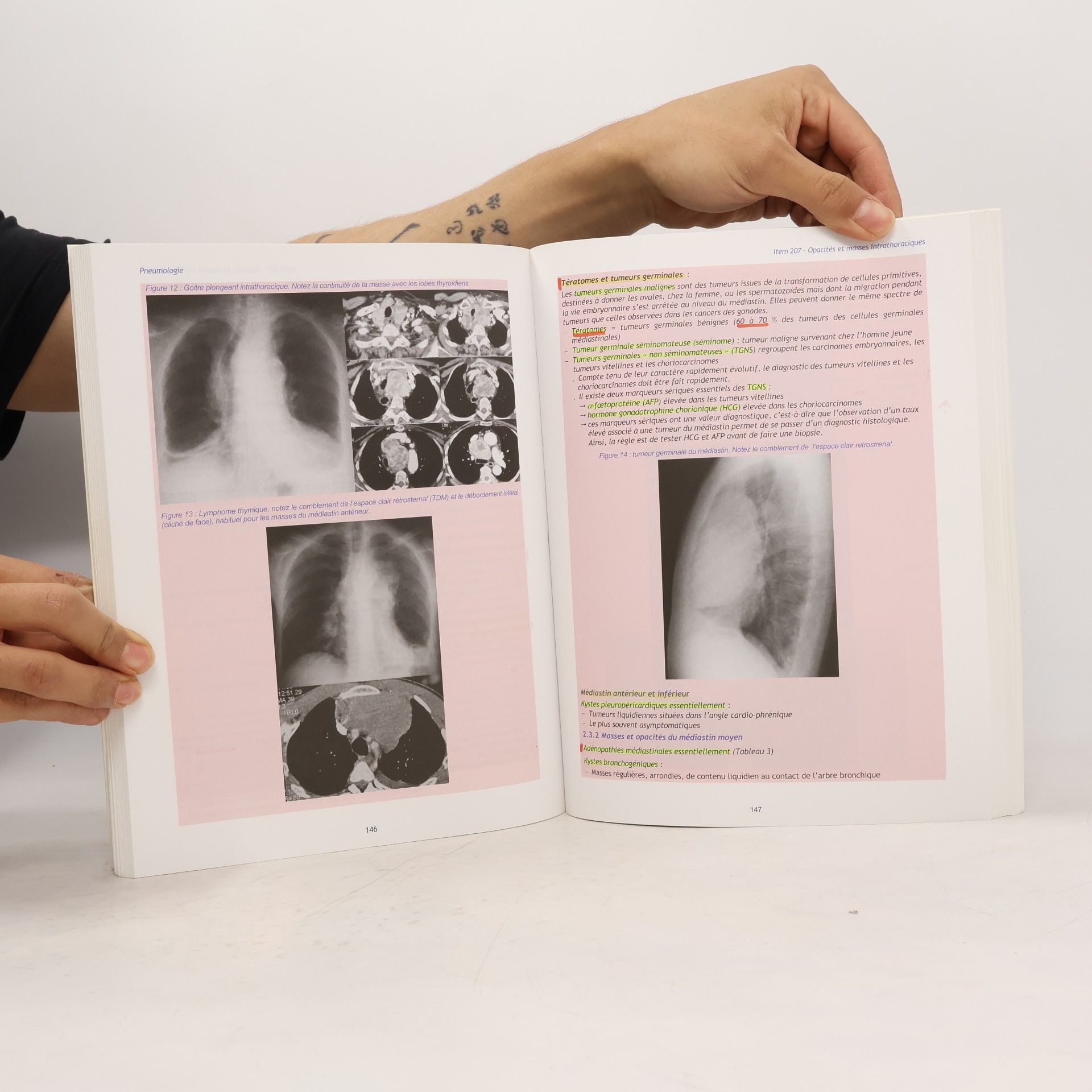 Collège des Enseignants de Pneumologie Référentiel ECN - 7: Pneumologie