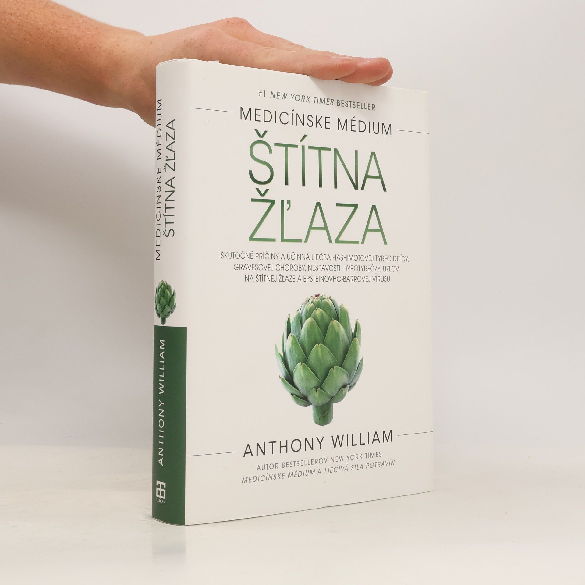 Anthony William Štítna žľaza