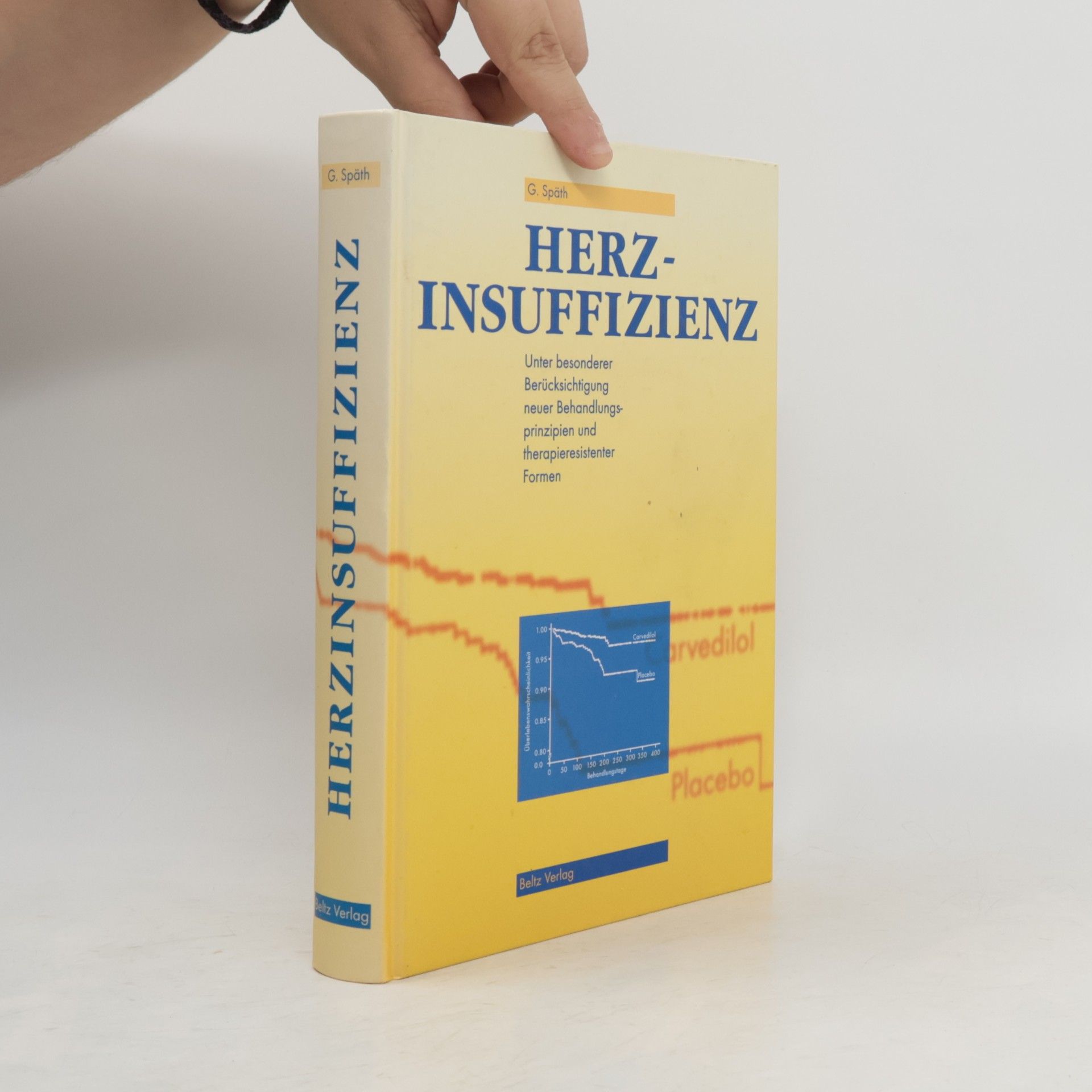 Gudrun Späth Herzinsuffizienz unter besonderer Berücksichtigung neuer Behandlungsprinzipien und therapieresisternter Form