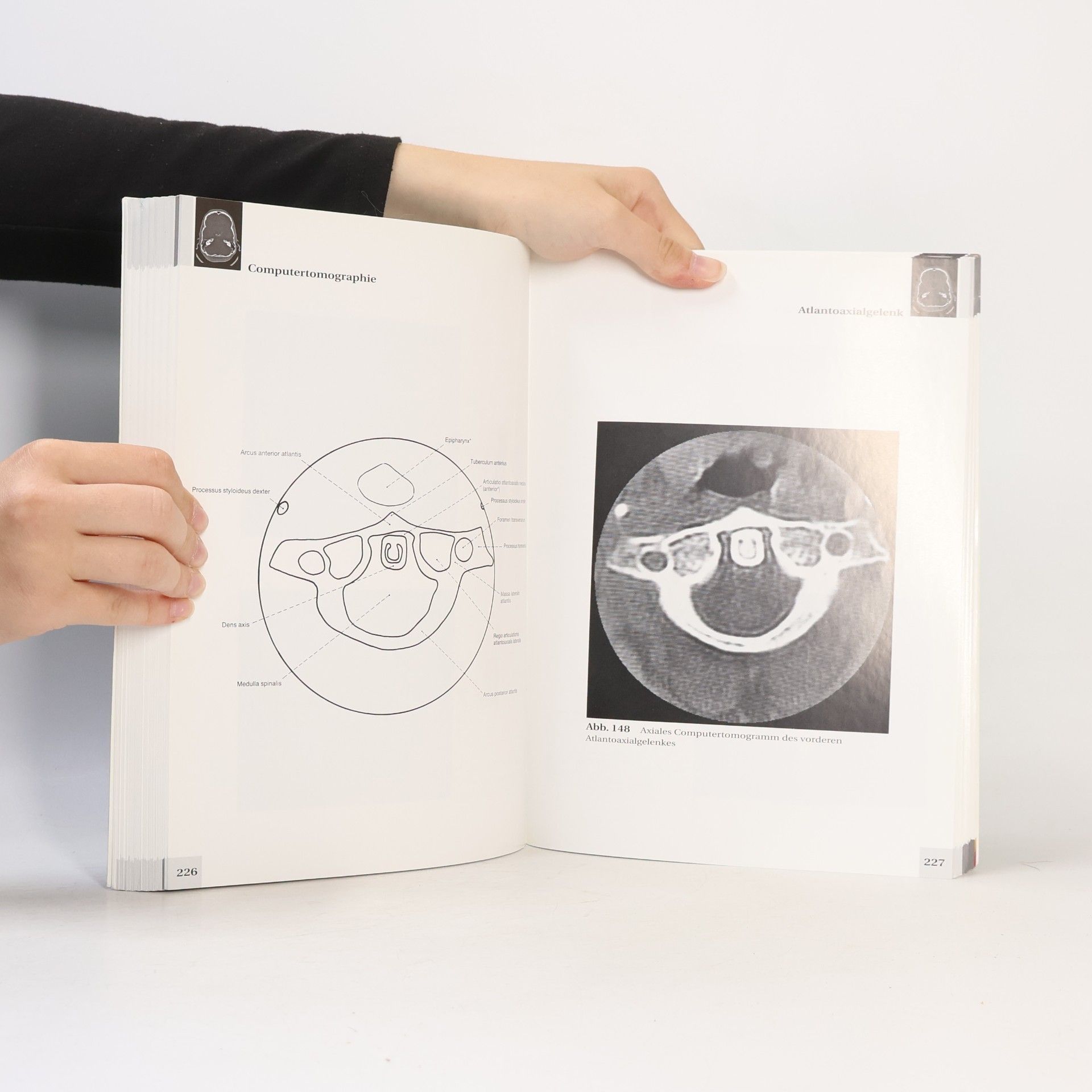 Lothar Wicke Atlas der Röntgenanatomie