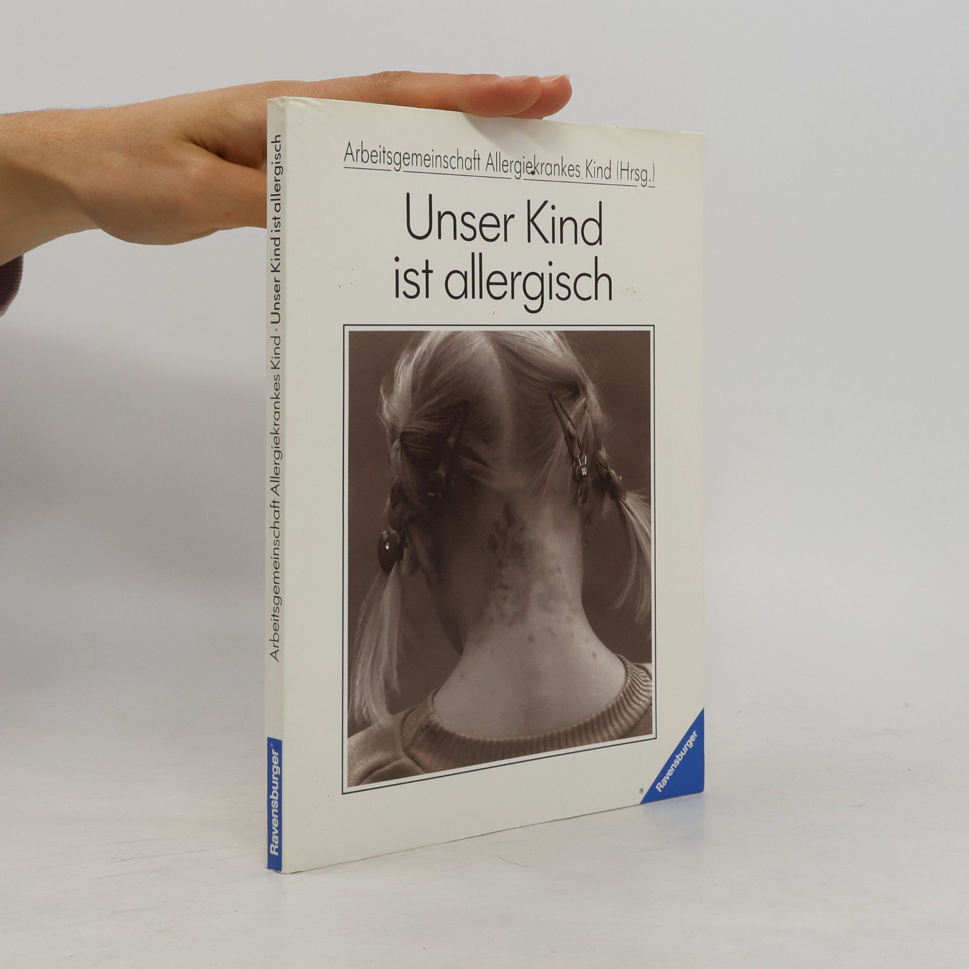 Autorenkollektiv Unser Kind ist allergisch