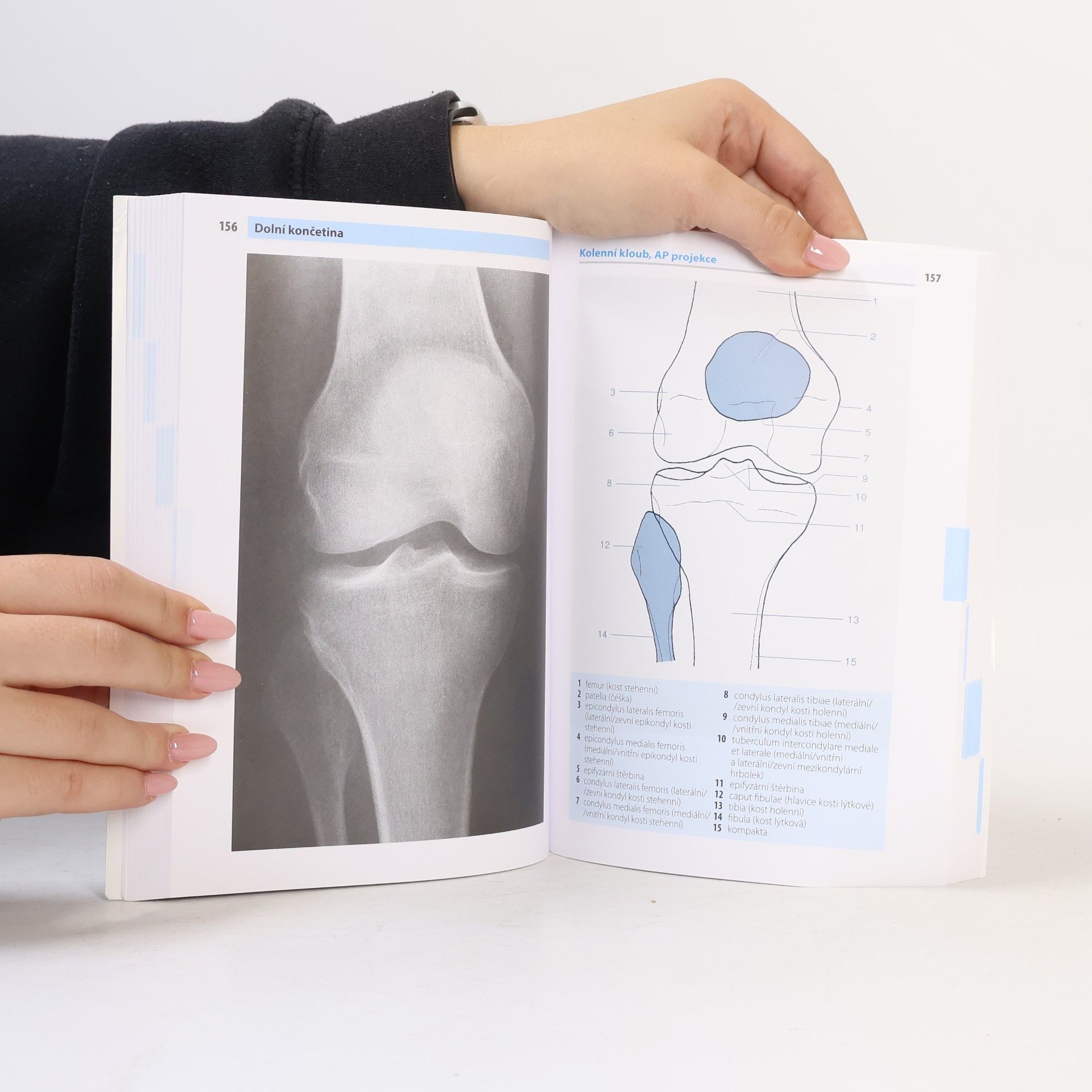 Torsten B. Möller Kapesní atlas rentgenové anatomie