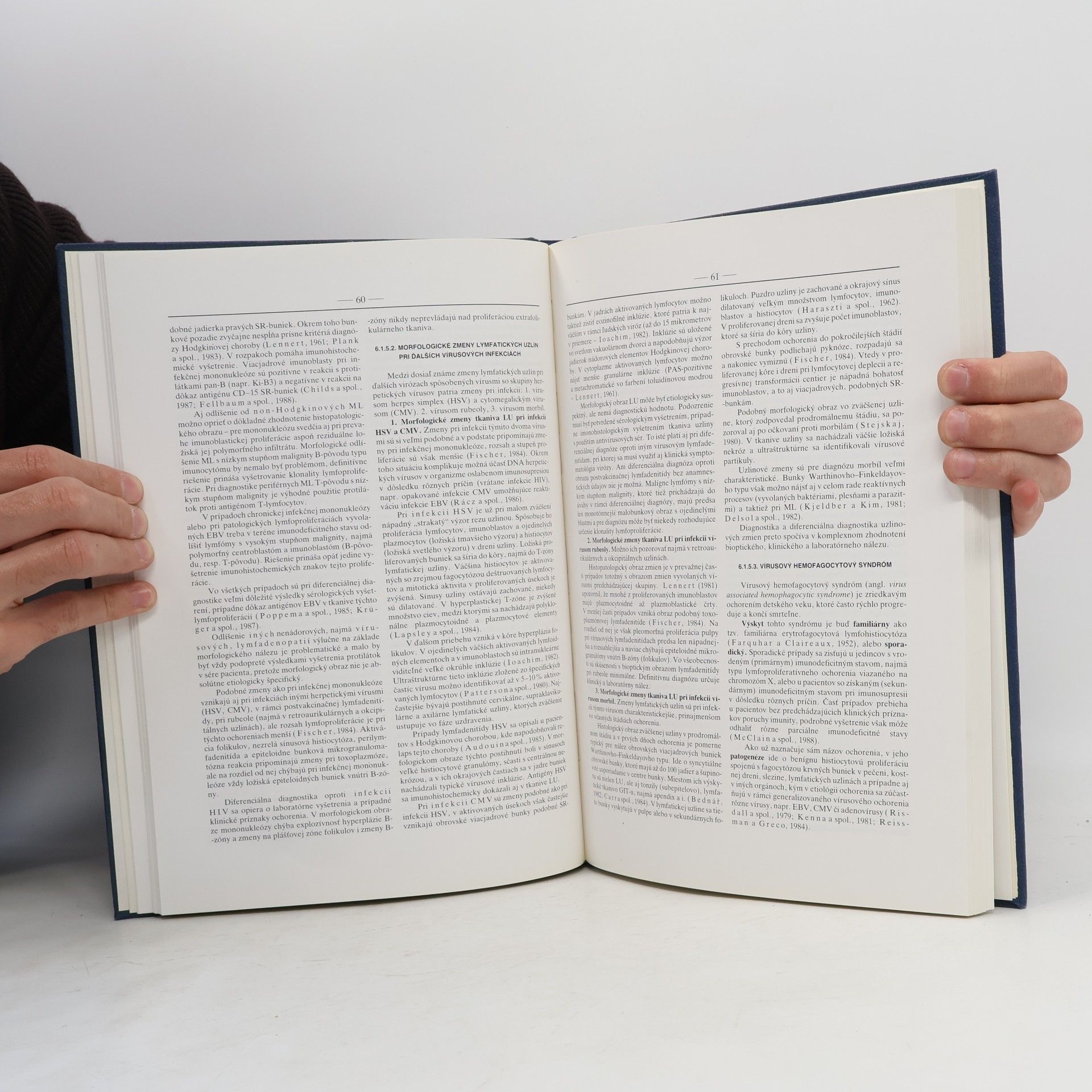 Ján Kliment Atlas biopsie nelymfómových lymfadenopatií