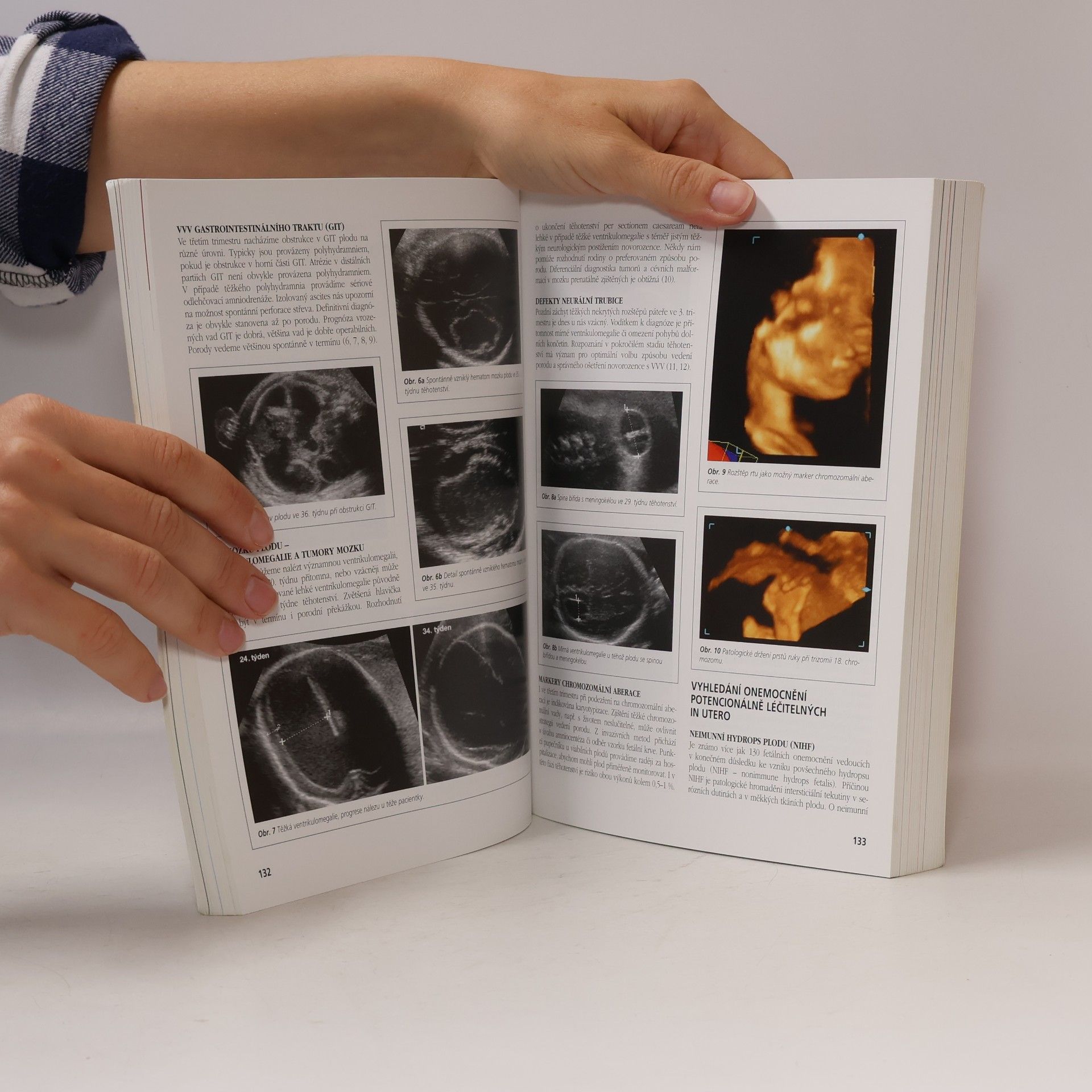 Pavel Calda Ultrazvuková diagnostika v těhotenství a gynekologii