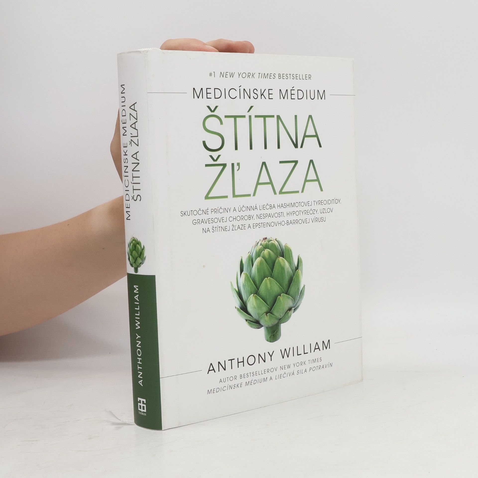 Anthony William Štítna žľaza