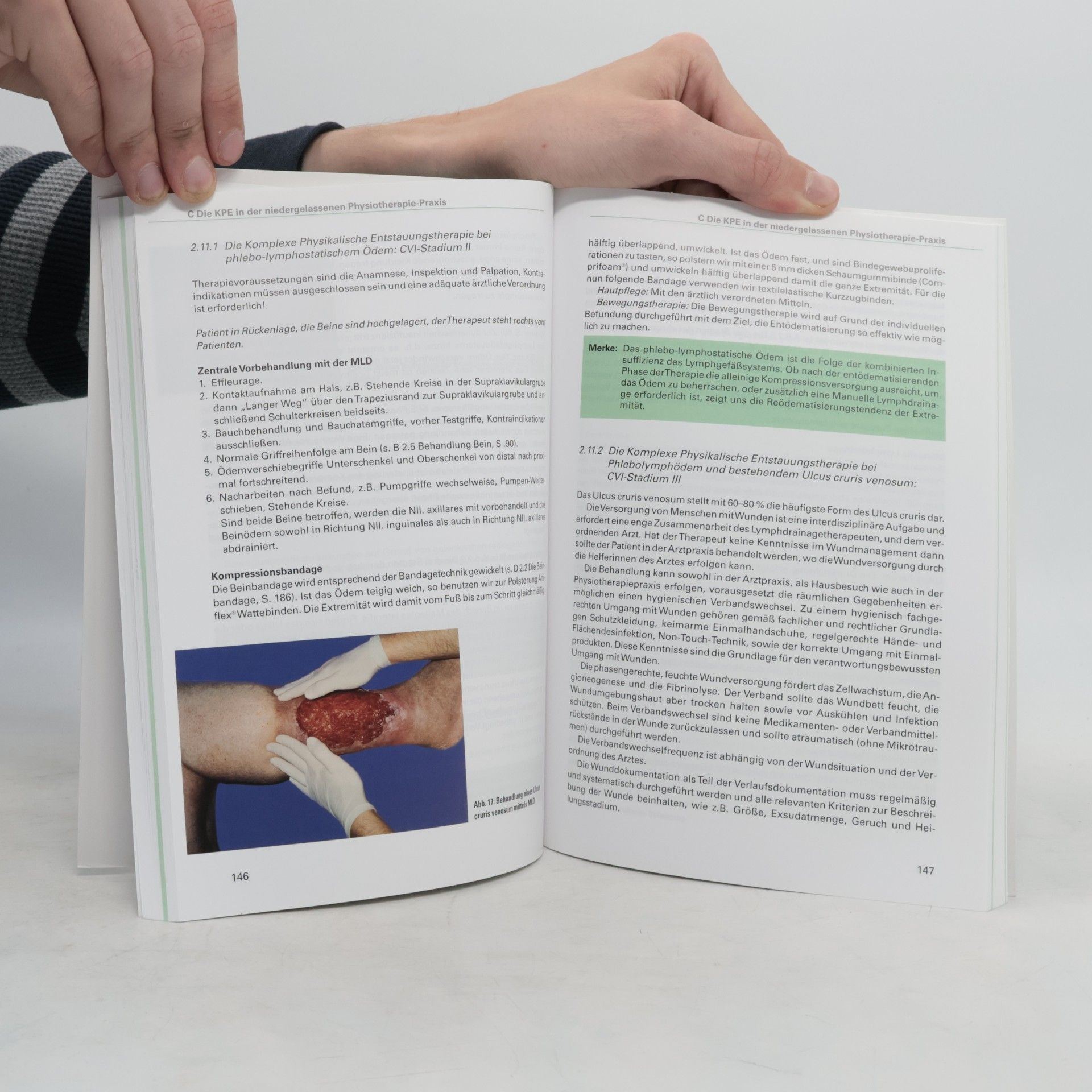 Hans Pritschow Das Lymphödem und die komplexe physikalische Entstauungstherapie