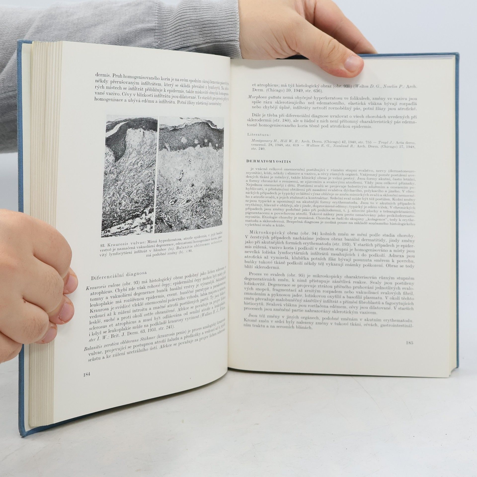 Jiří Trapl Histopathologie kožních chorob
