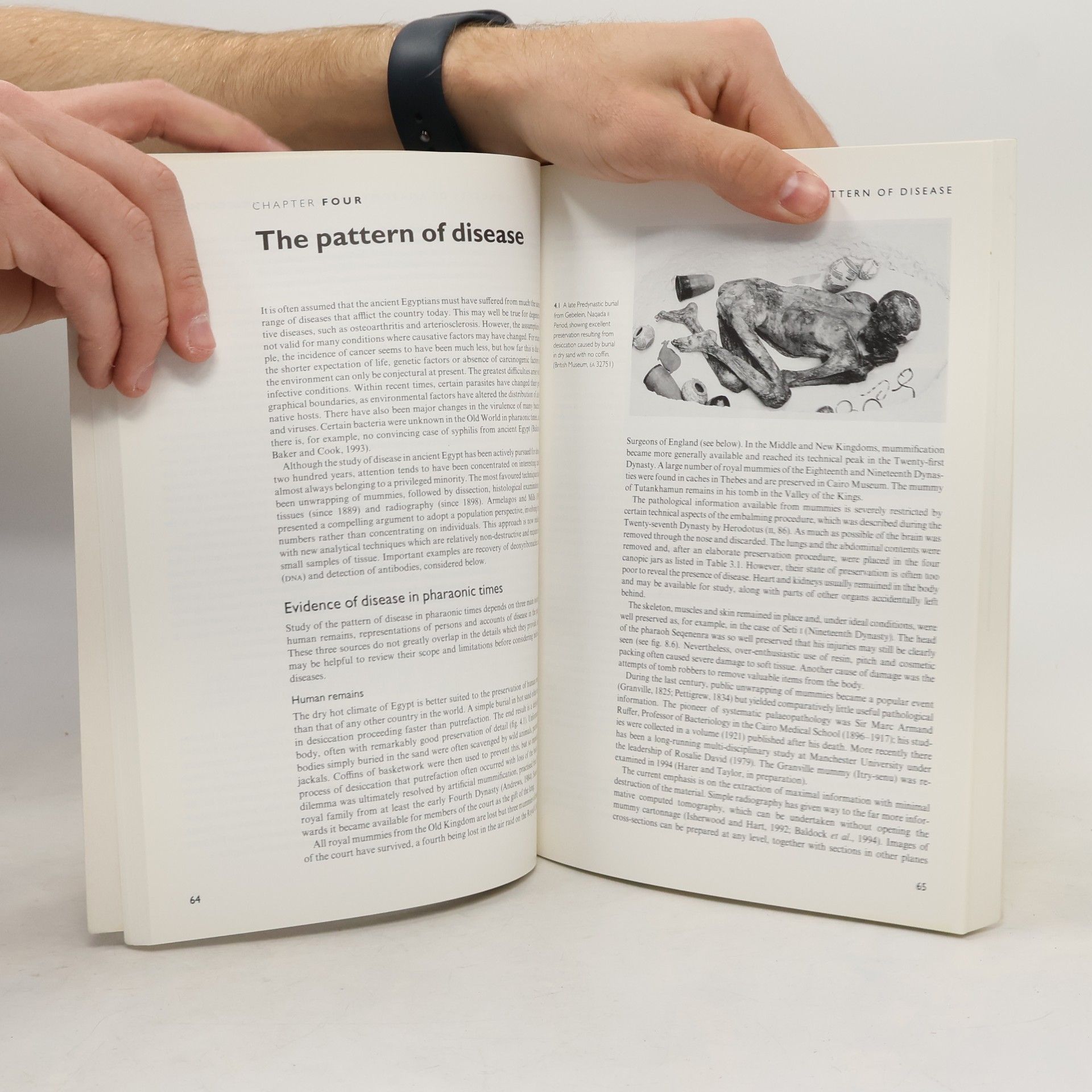 John F. Nunn Ancient Egyptian Medicine