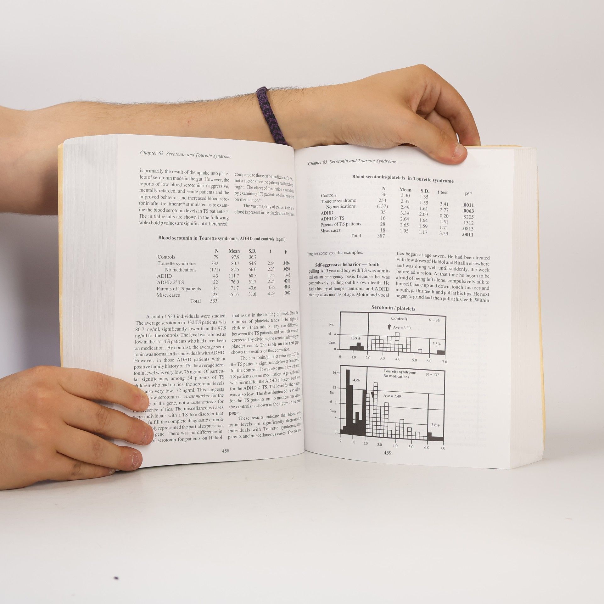 David E. Comings Tourette Syndrome and Human Behavior