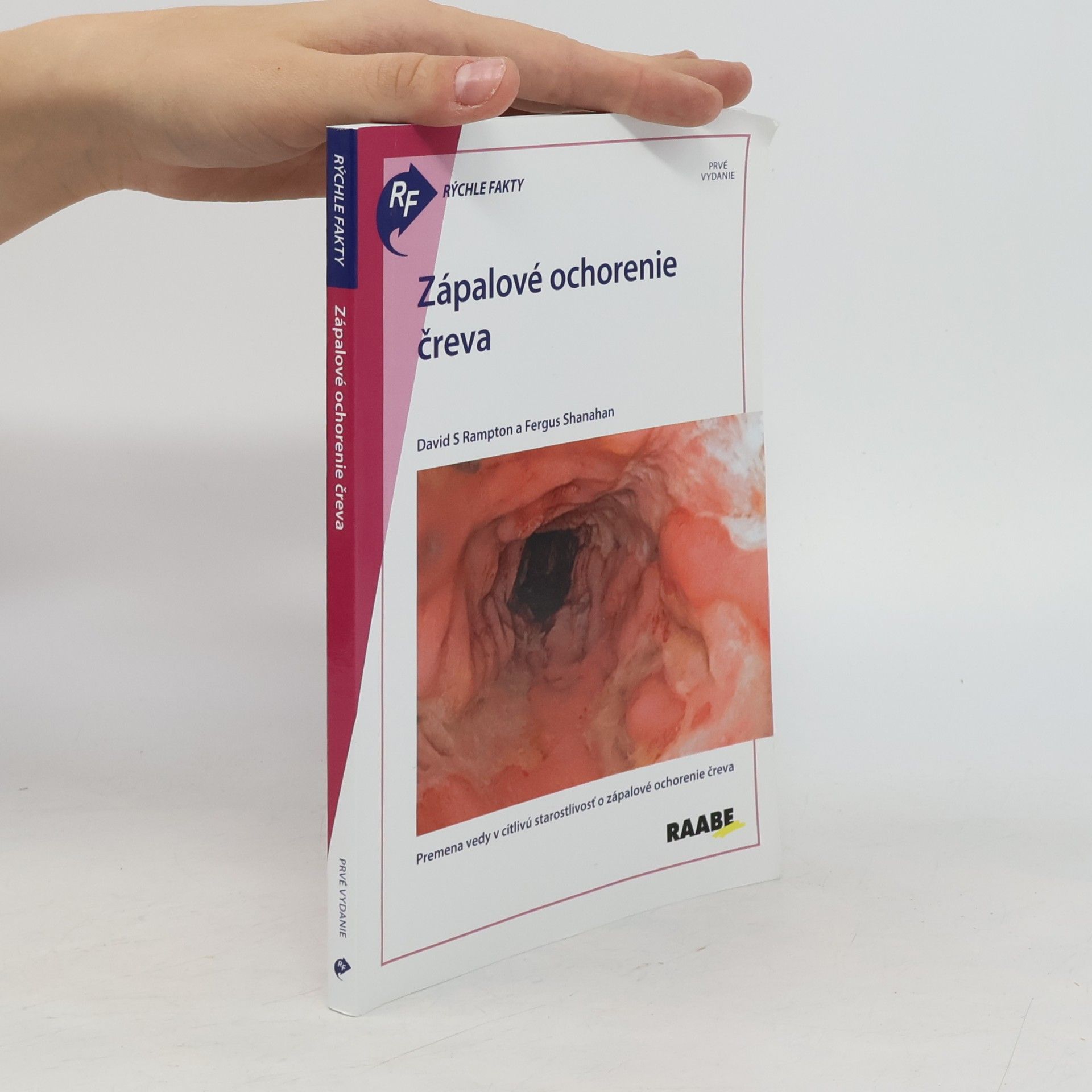 Various authors Rýchle fakty: Zápalové ochorenie čreva