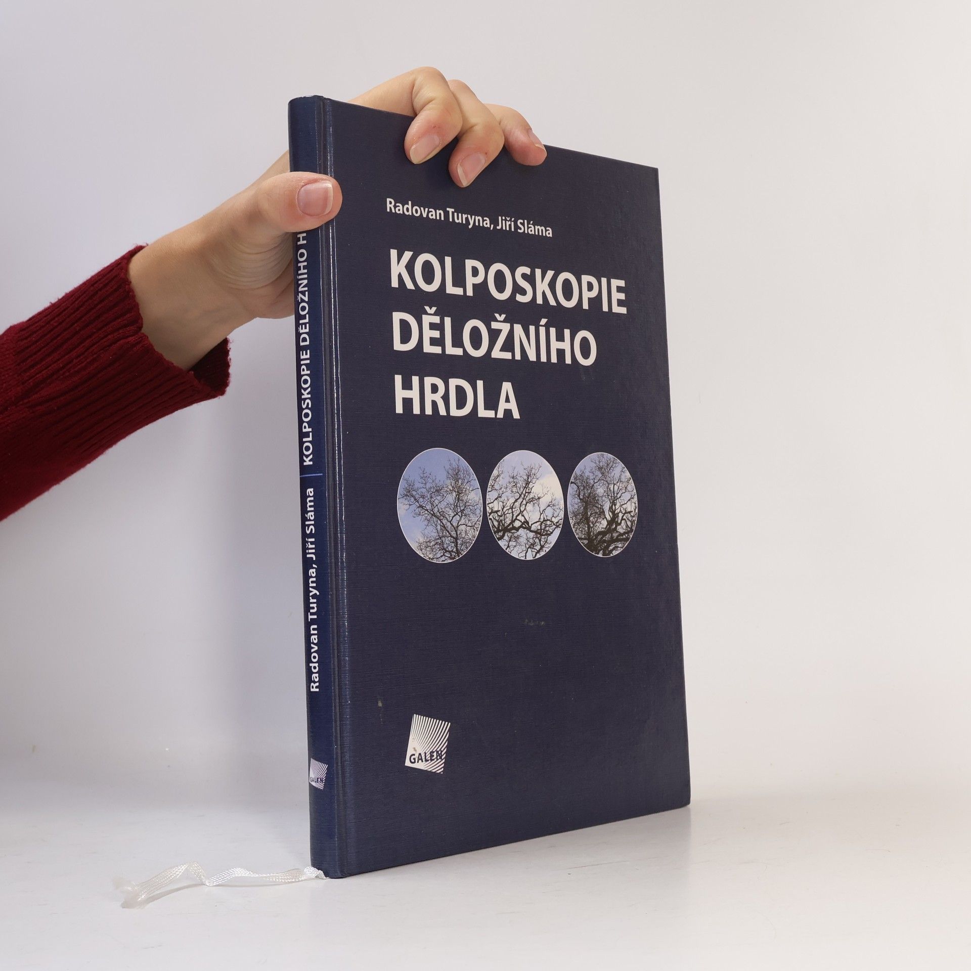 Radovan Turyna Kolposkopie děložního hrdla